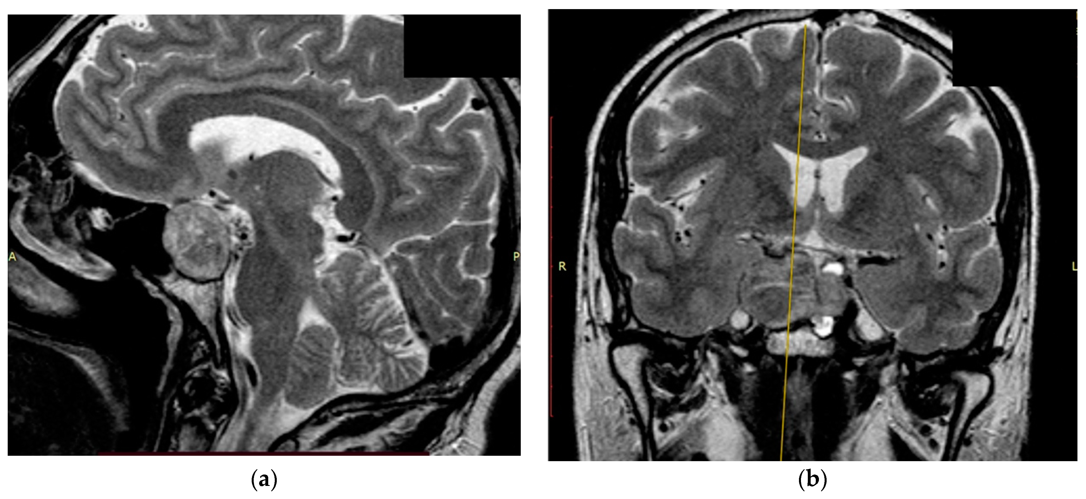 Bioengineering 09 00052 g003 550