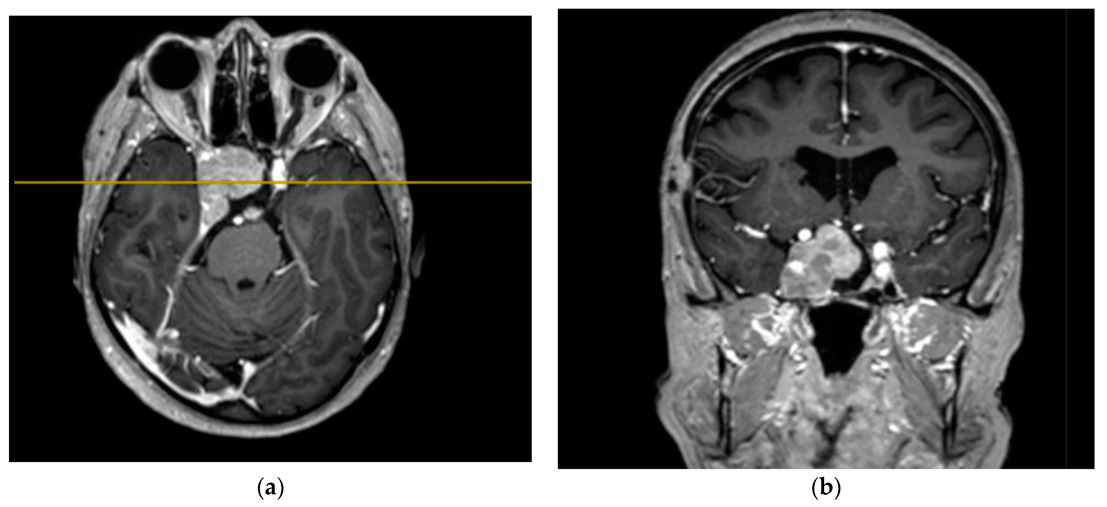 Bioengineering 09 00052 g004 550
