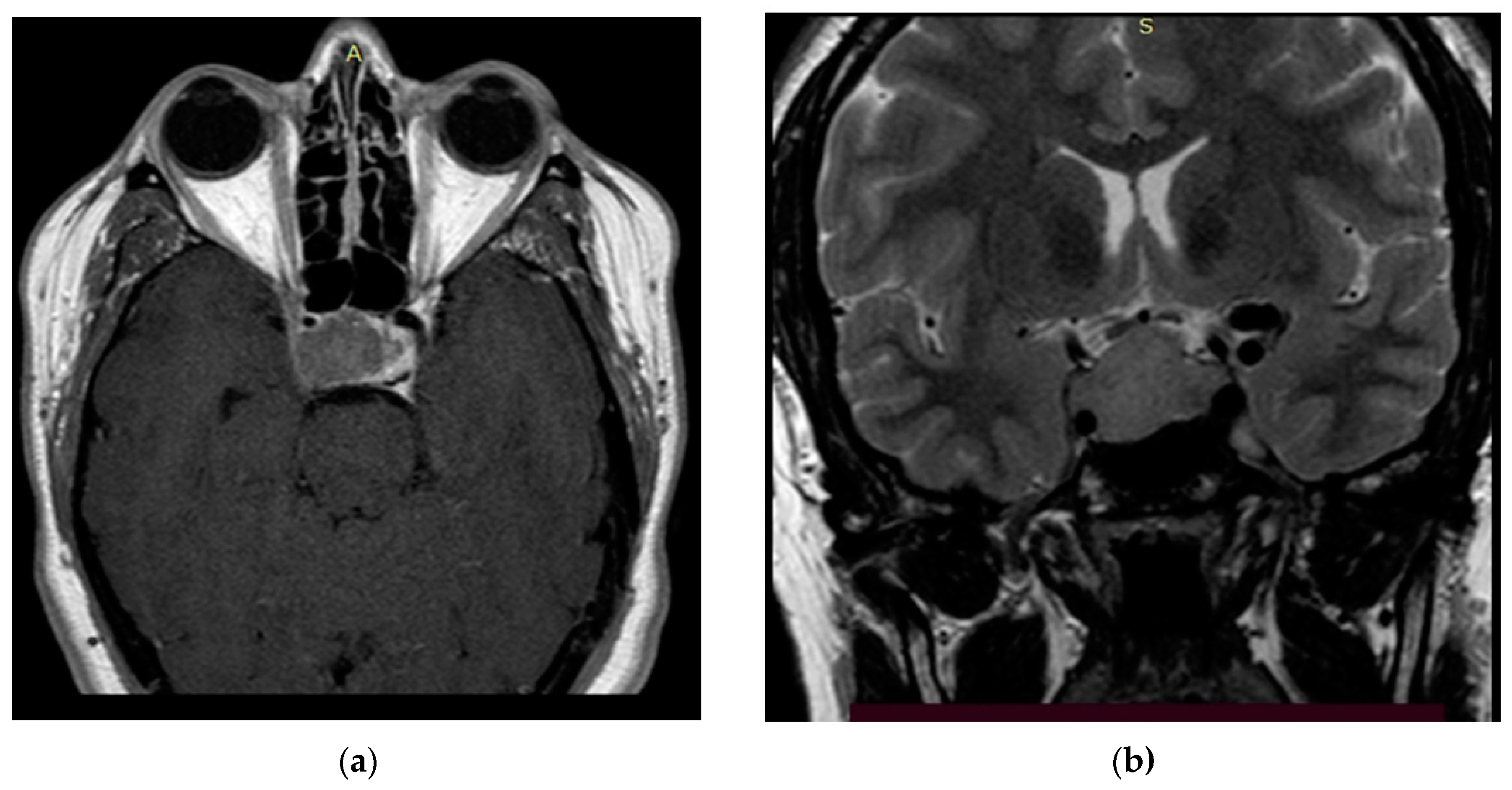 Bioengineering 09 00052 g005 550