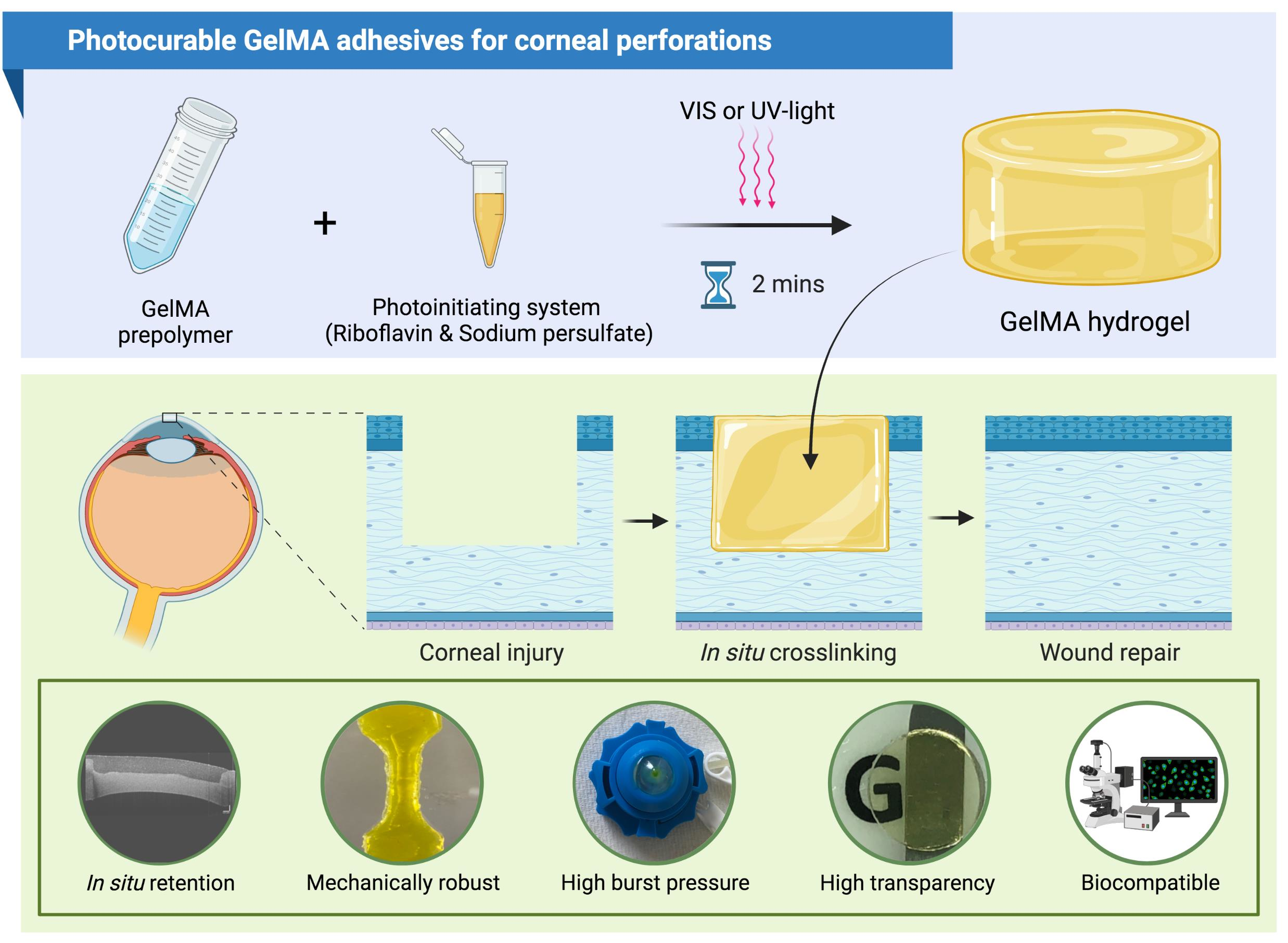 Bioengineering Free FullText Photocurable GelMA Adhesives for