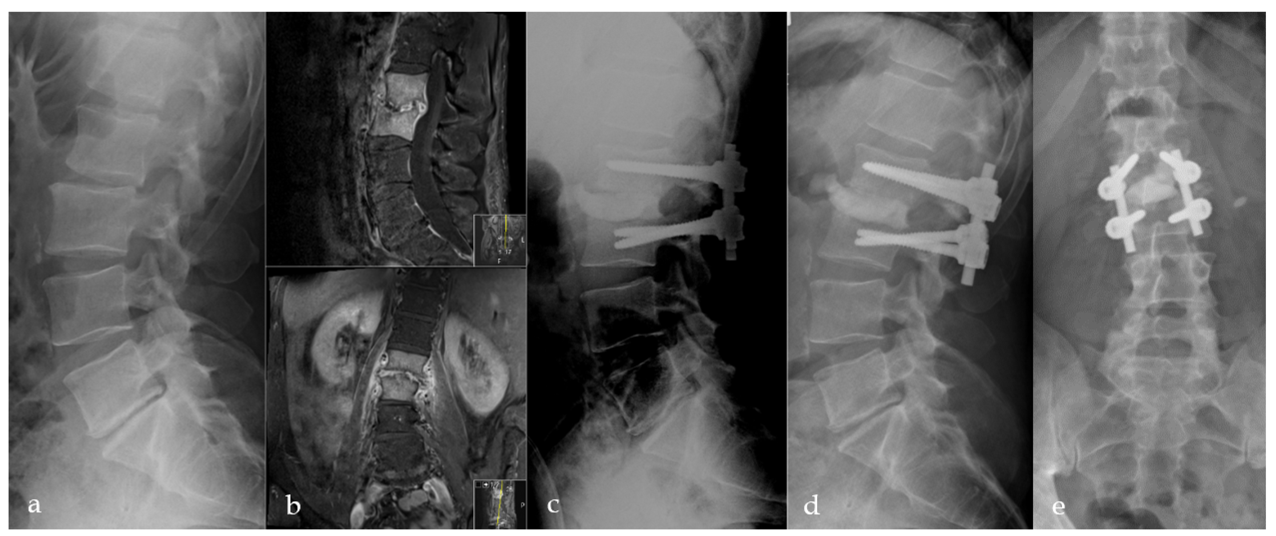 Bioengineering 09 00073 g004 Bioengineering 09 00073 g004