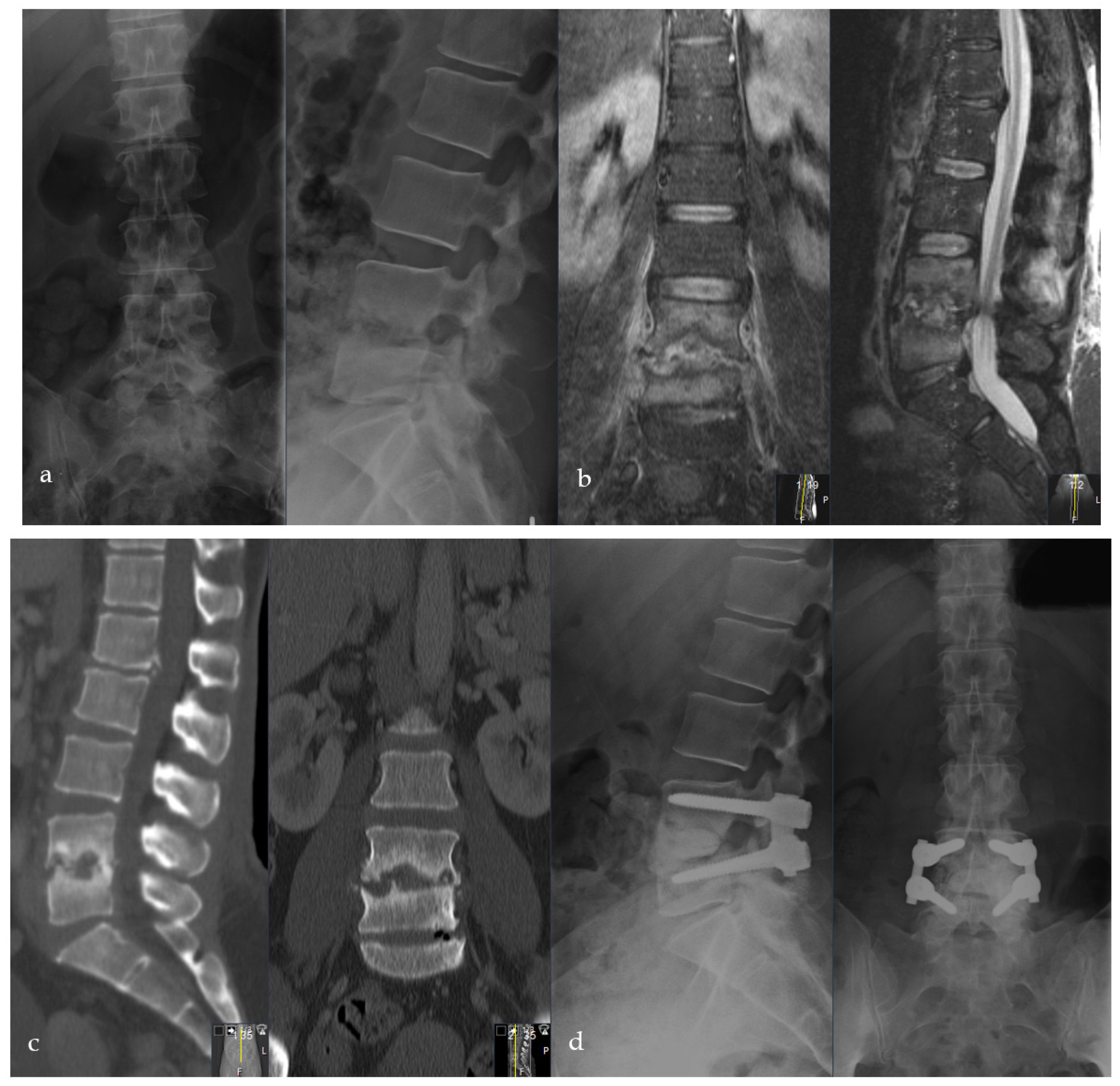 Bioengineering 09 00073 g005a Bioengineering 09 00073 g005a