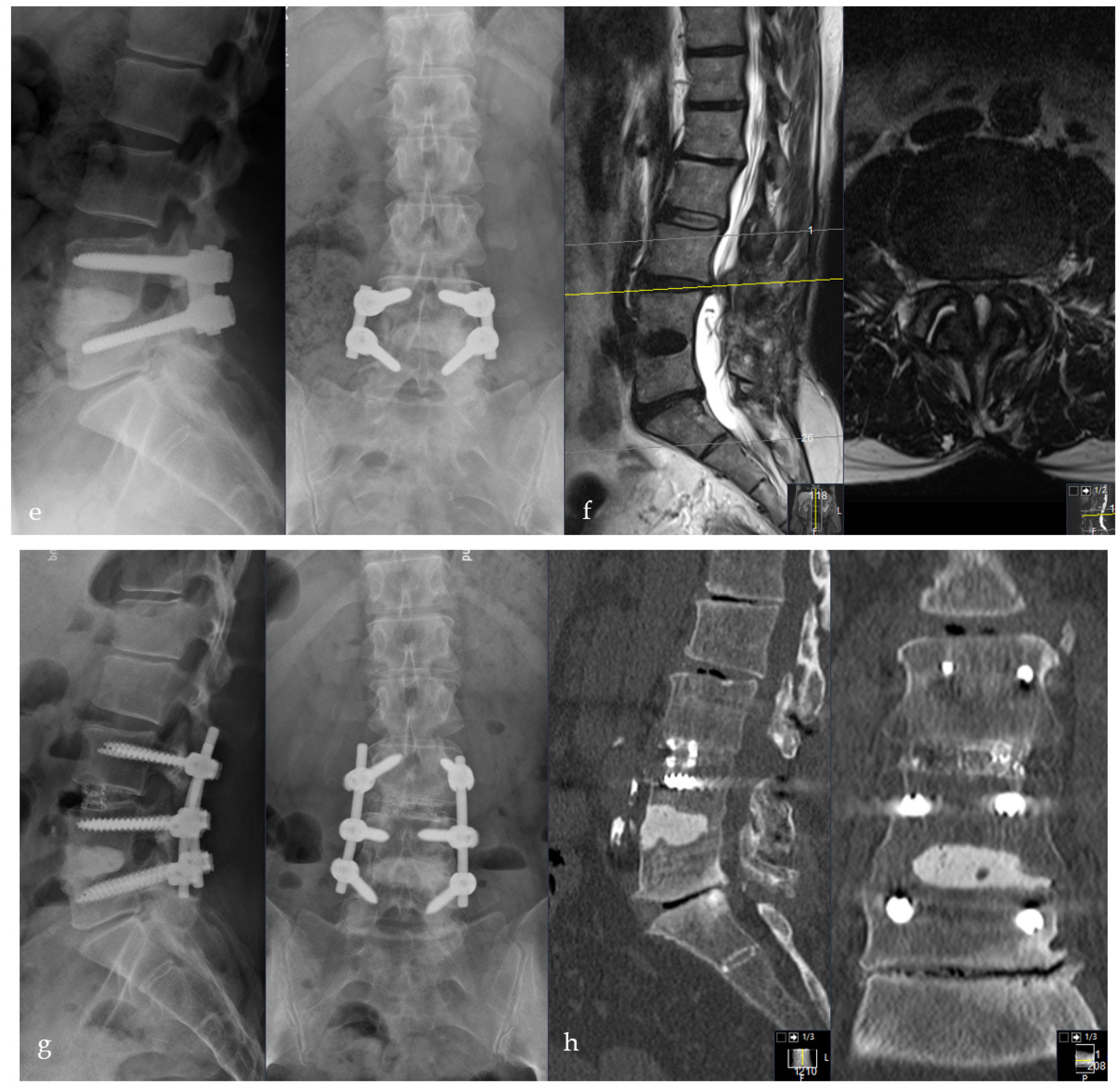 Bioengineering 09 00073 g005b Bioengineering 09 00073 g005b