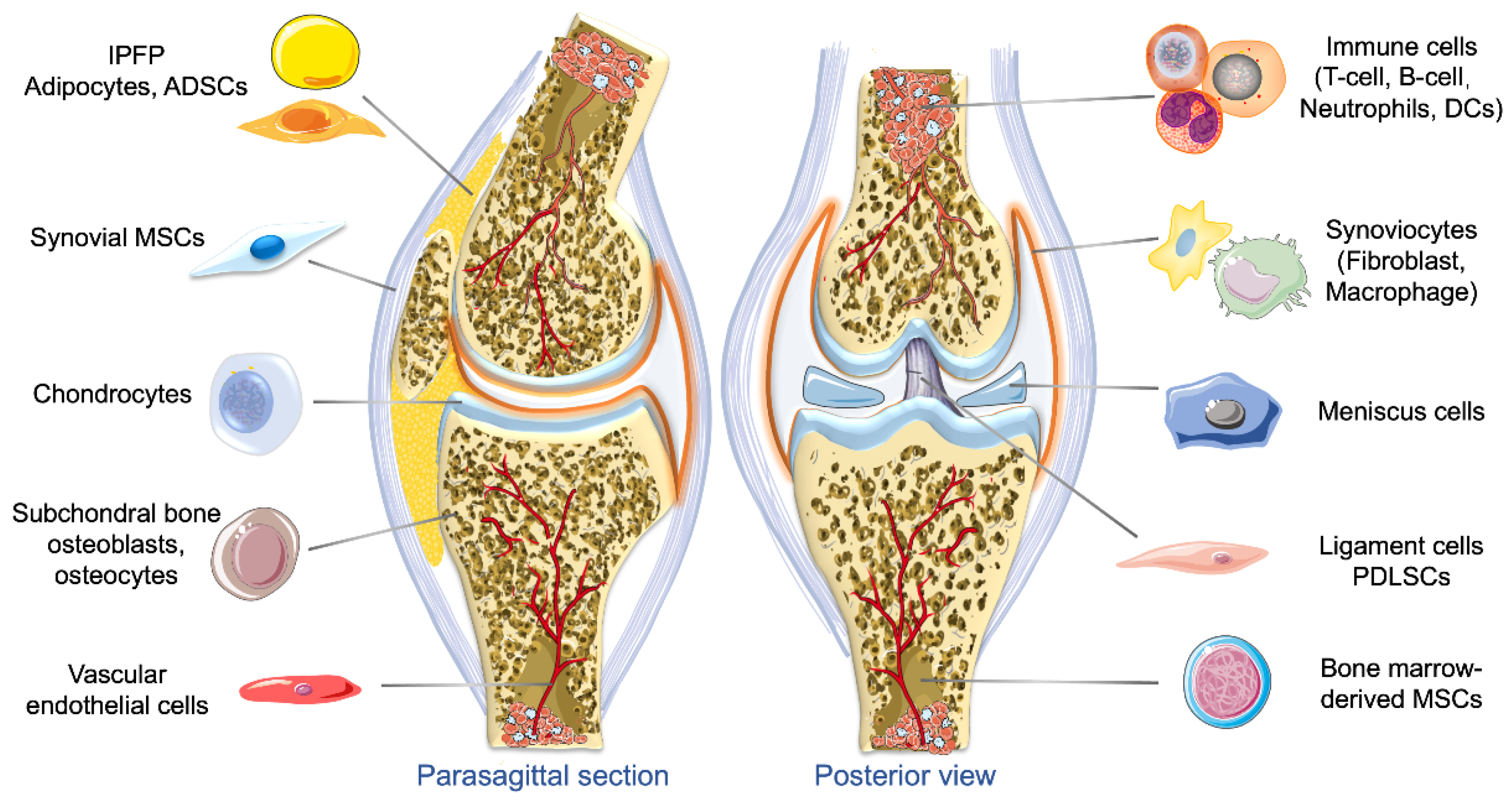 PDF) Excessive mechanical loading promotes osteoarthritis through