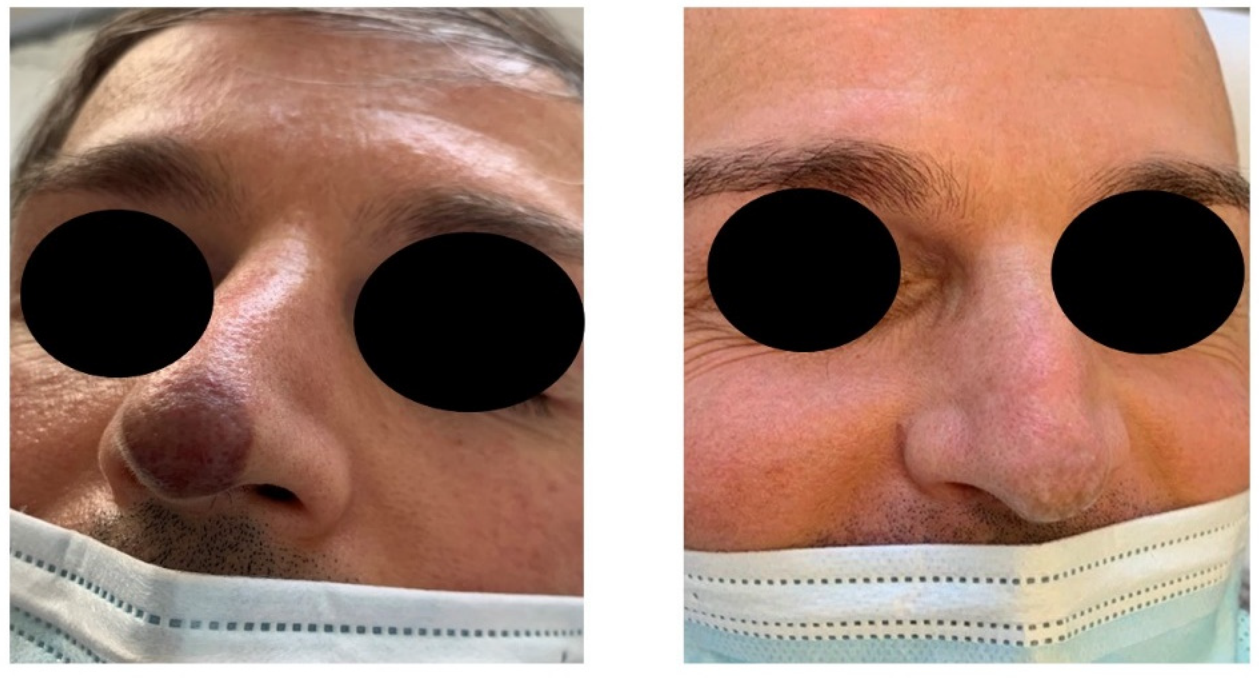 Bioengineering 09 00106 g002