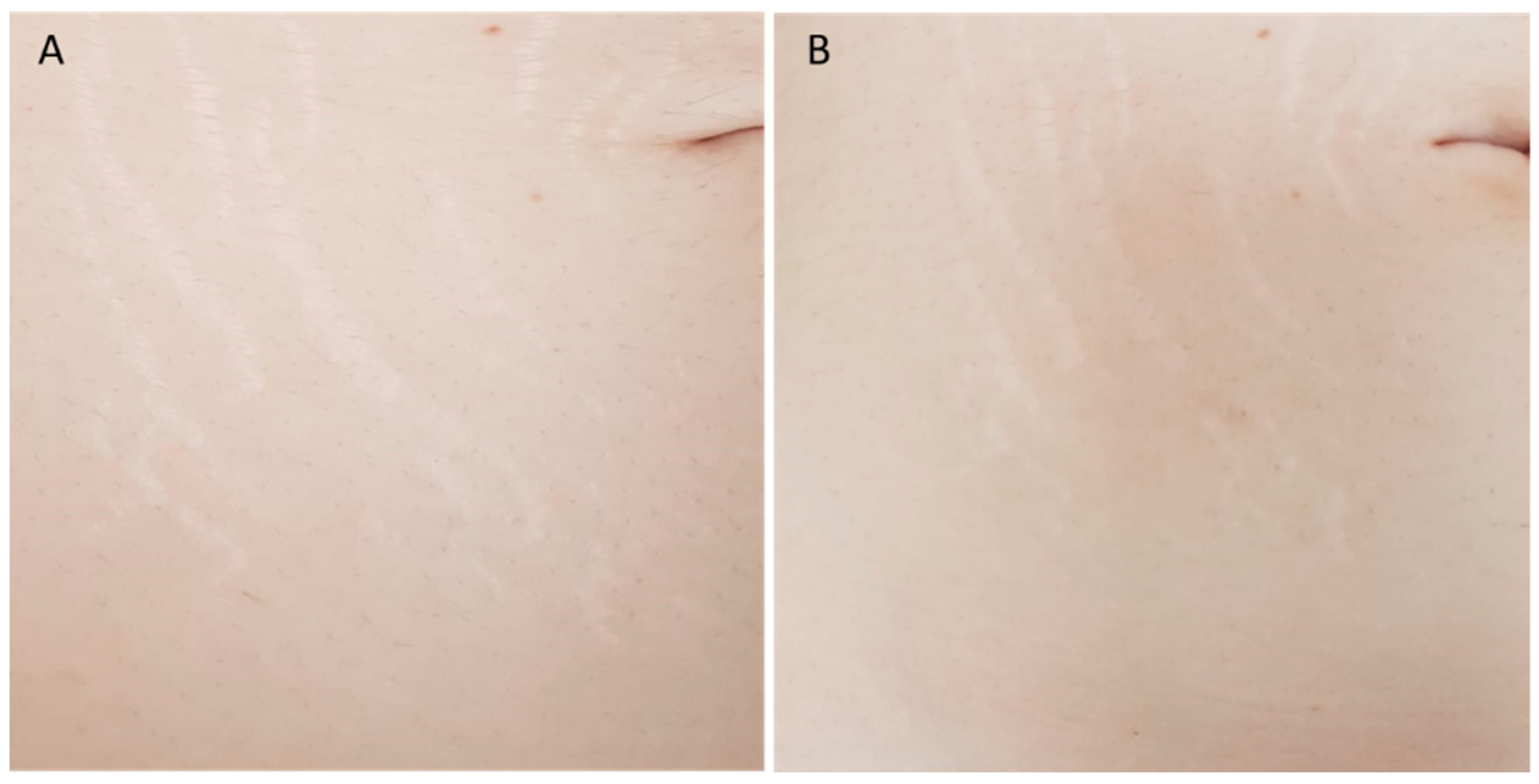 Bioengineering 09 00139 g004 Bioengineering 09 00139 g004