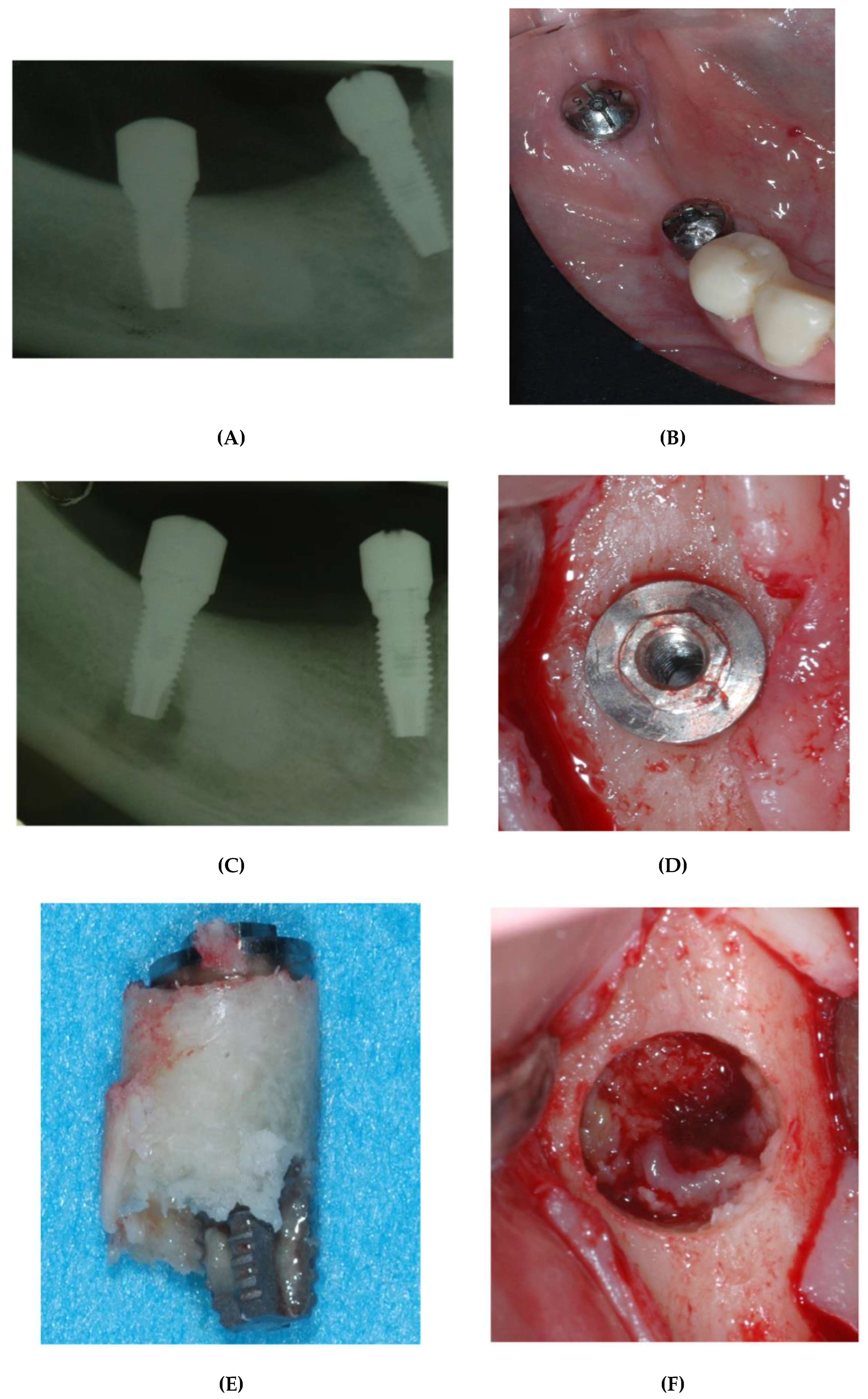 Bioengineering 09 00145 g003 550