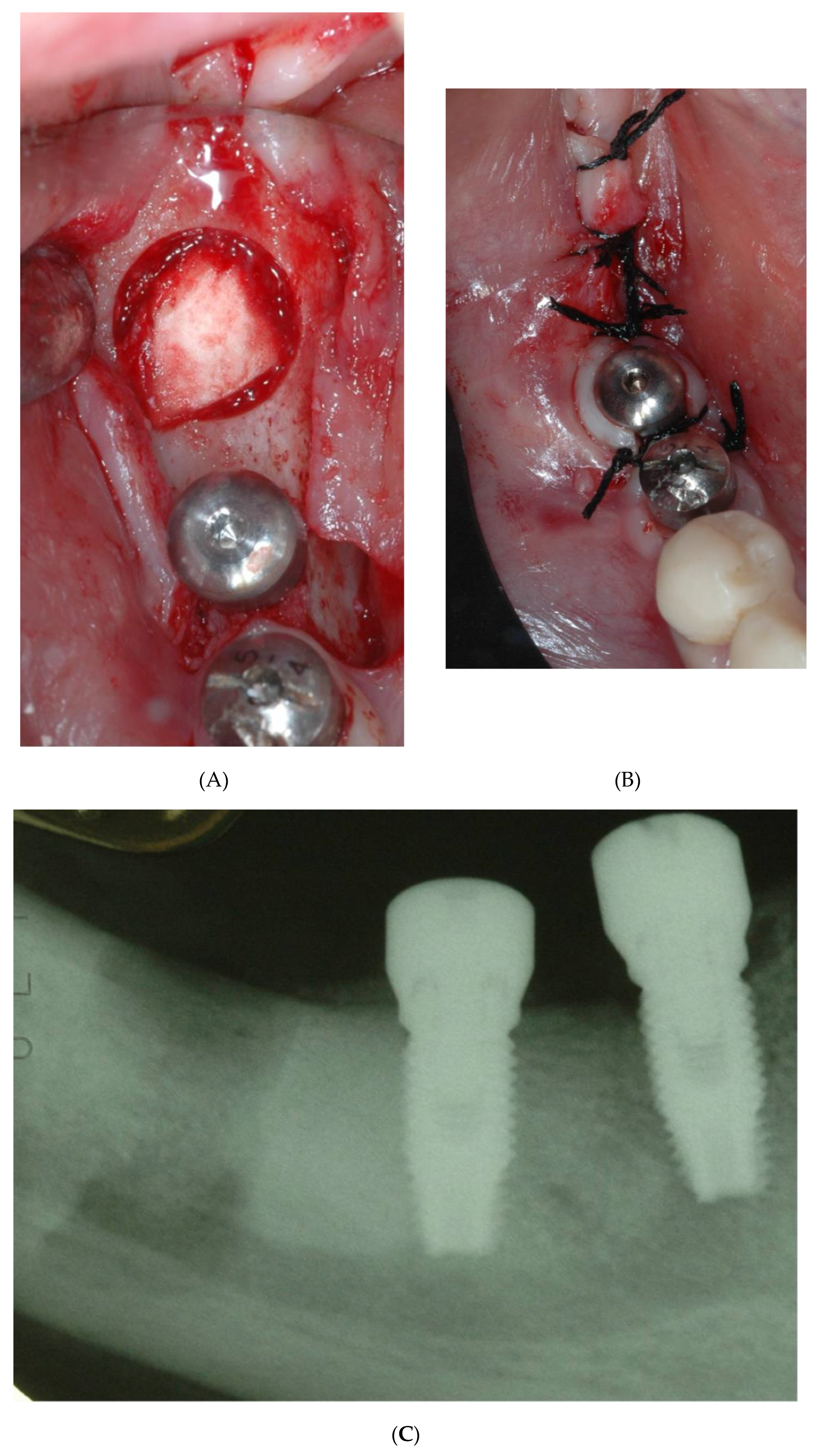 Bioengineering 09 00145 g004a 550