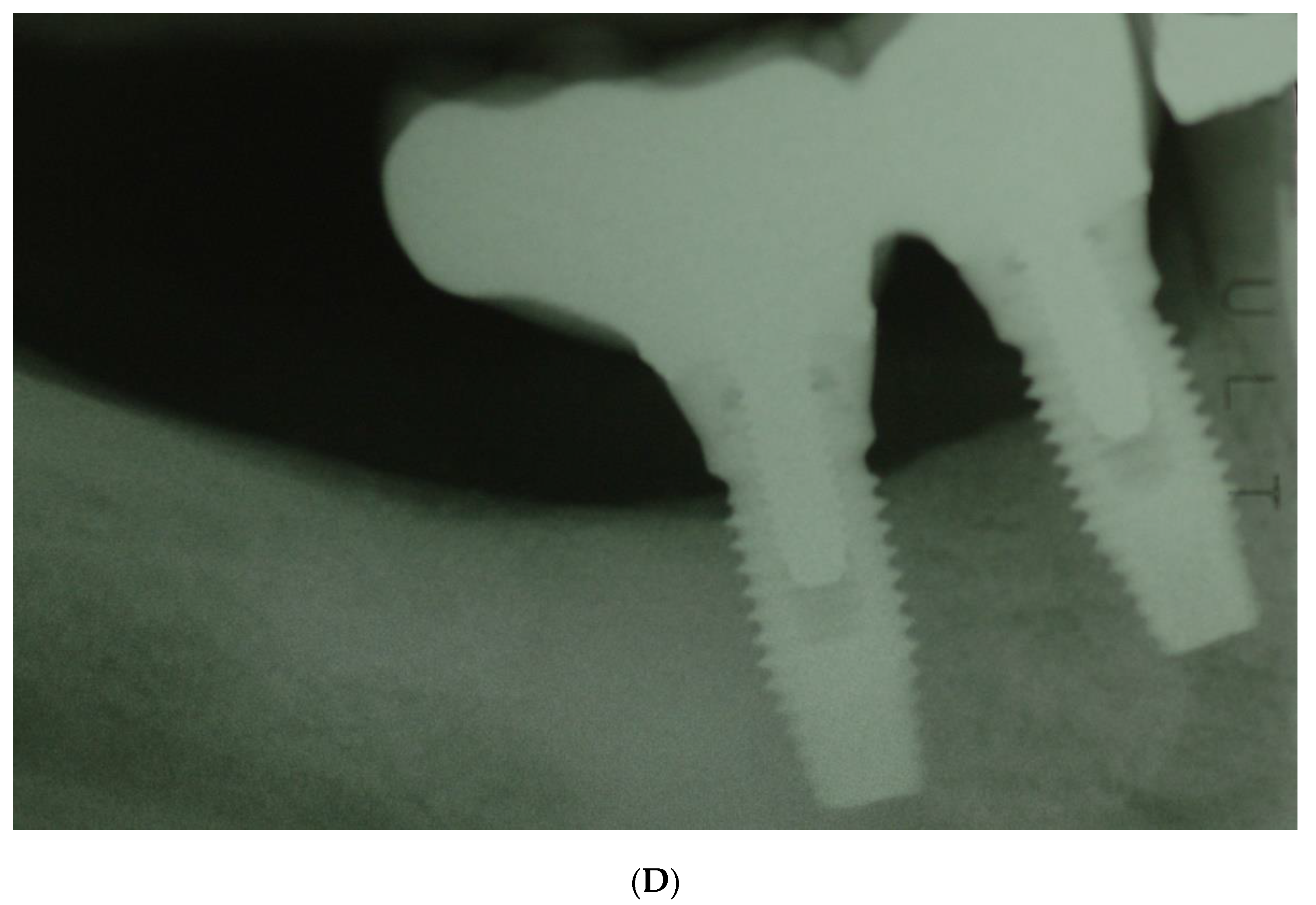 Bioengineering 09 00145 g004b 550