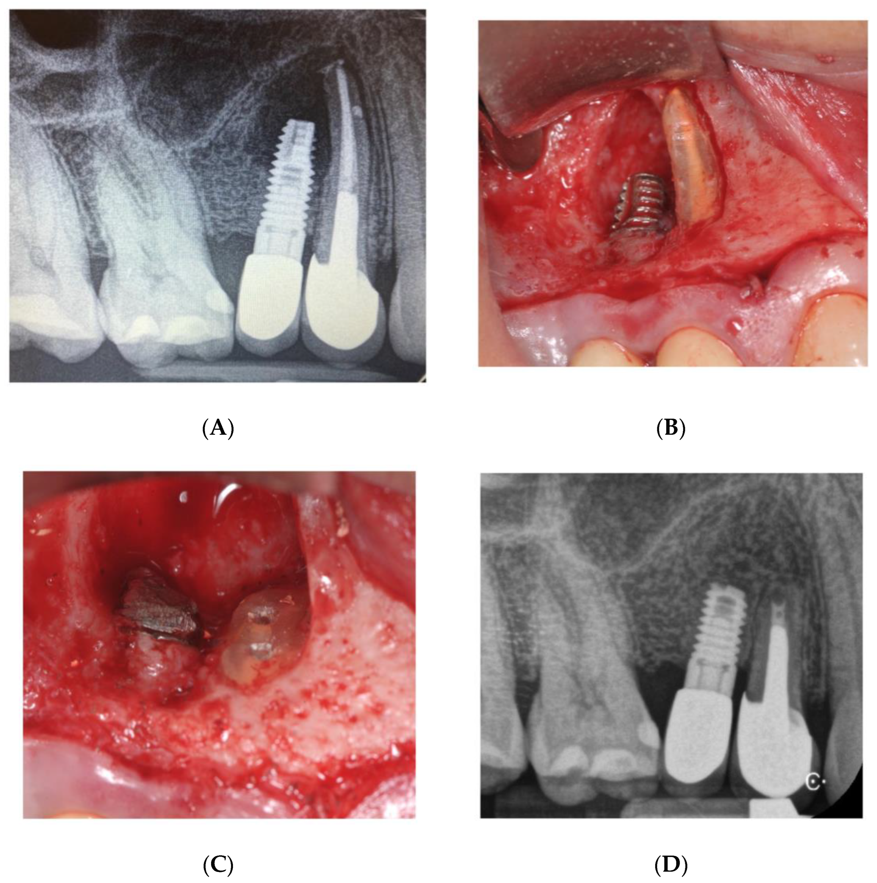 Bioengineering 09 00145 g006 550