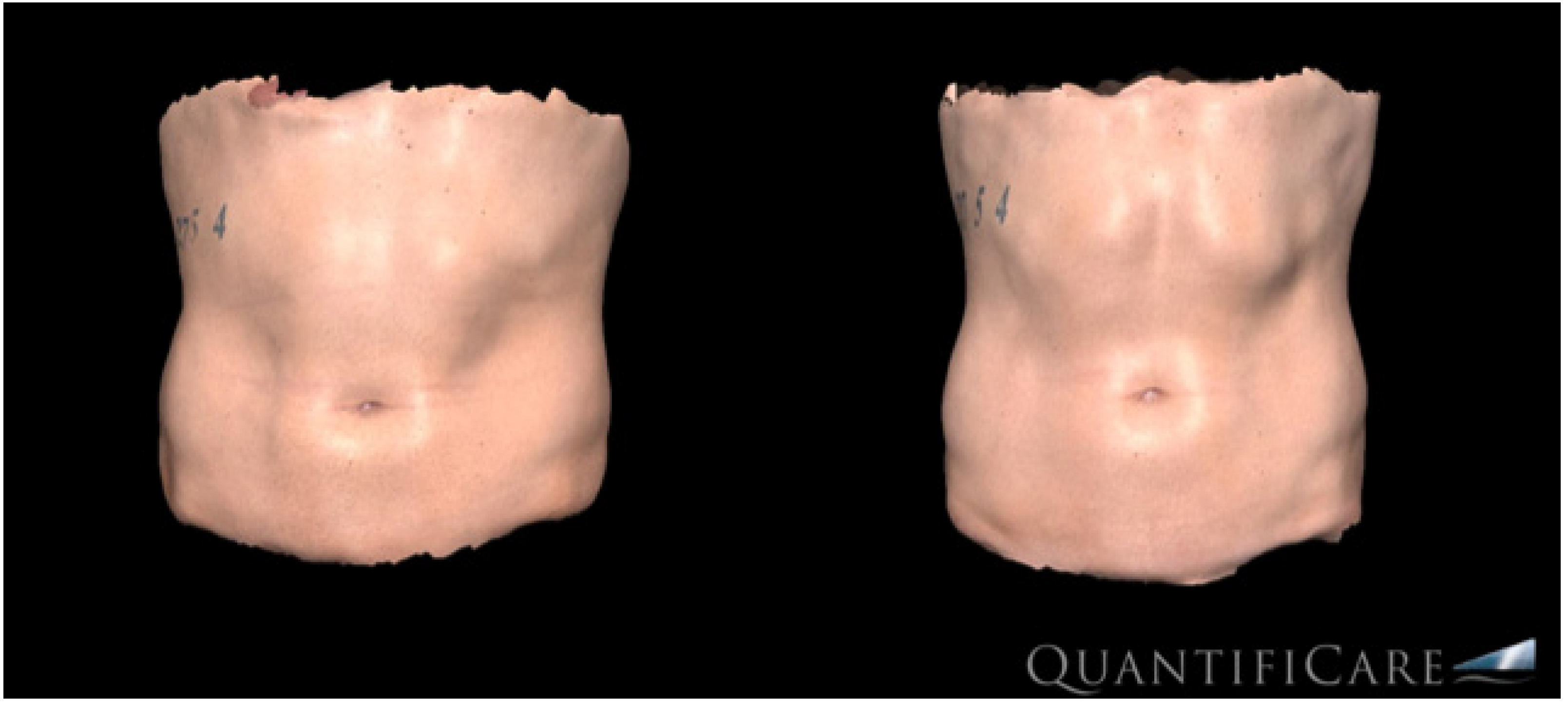 Bioengineering 09 00182 g001 550