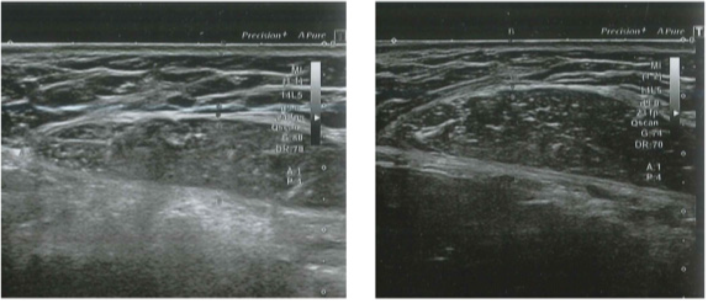 Bioengineering 09 00182 g002 550