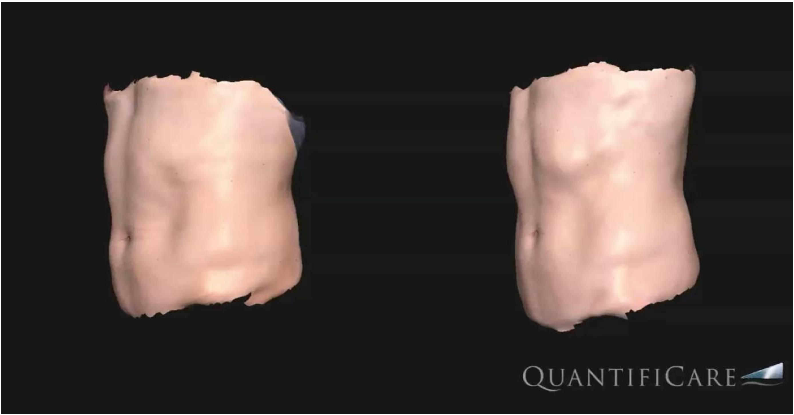 Bioengineering 09 00182 g003 550