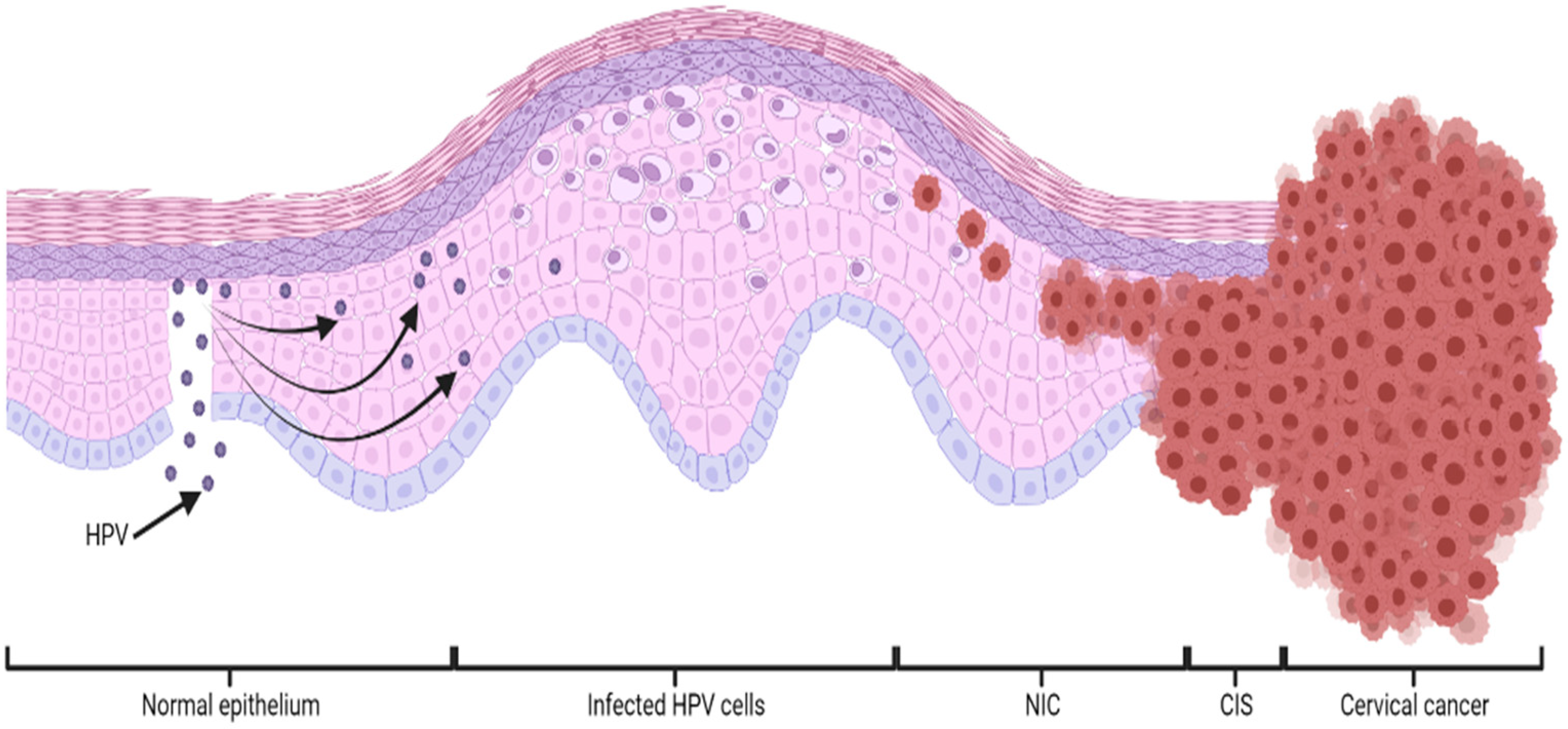Hpv vírus warzen. Papilloma warzen, Hpv infektion warzen,