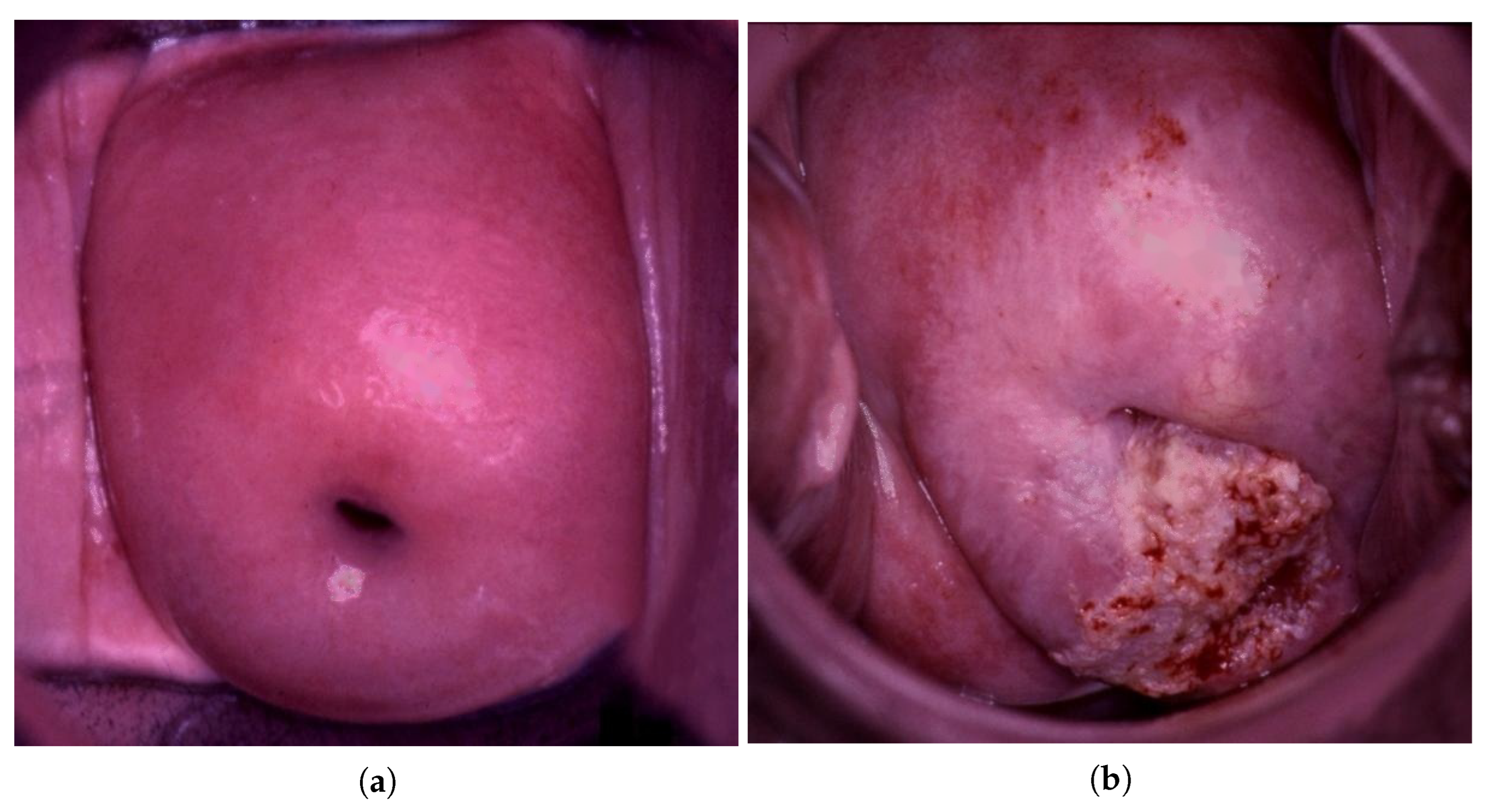 Bioengineering 09 00240 g003 550