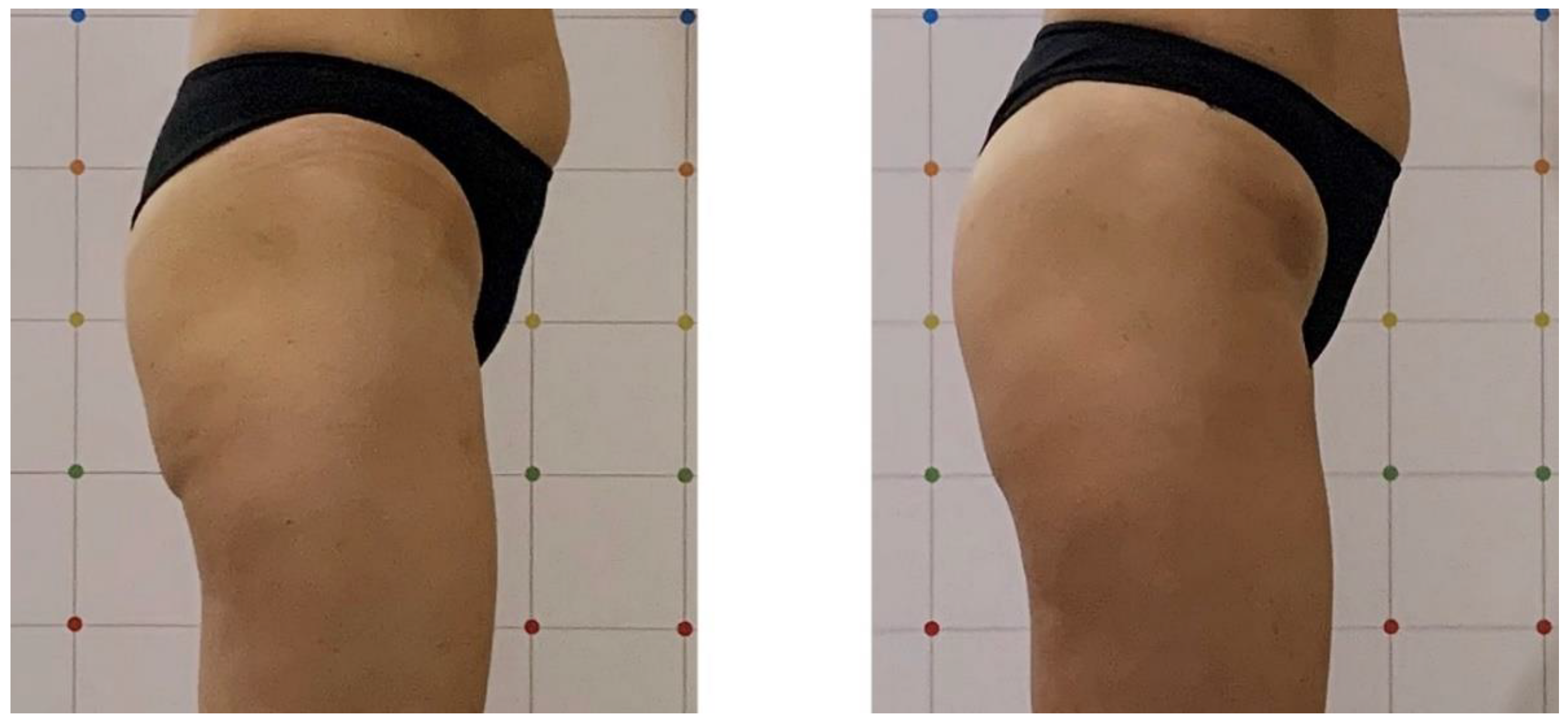 Bioengineering 09 00284 g002 550