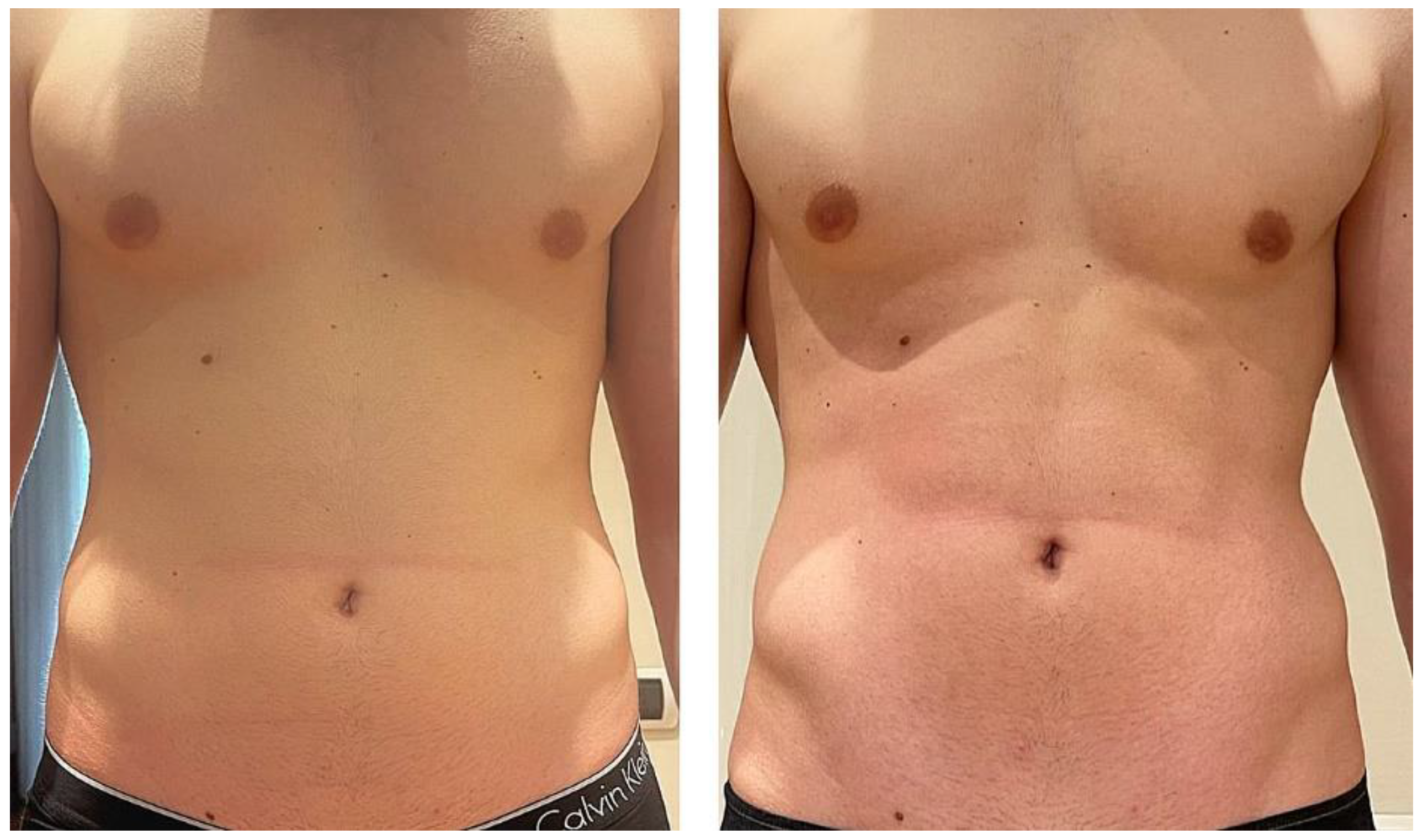 Bioengineering 09 00284 g003 550