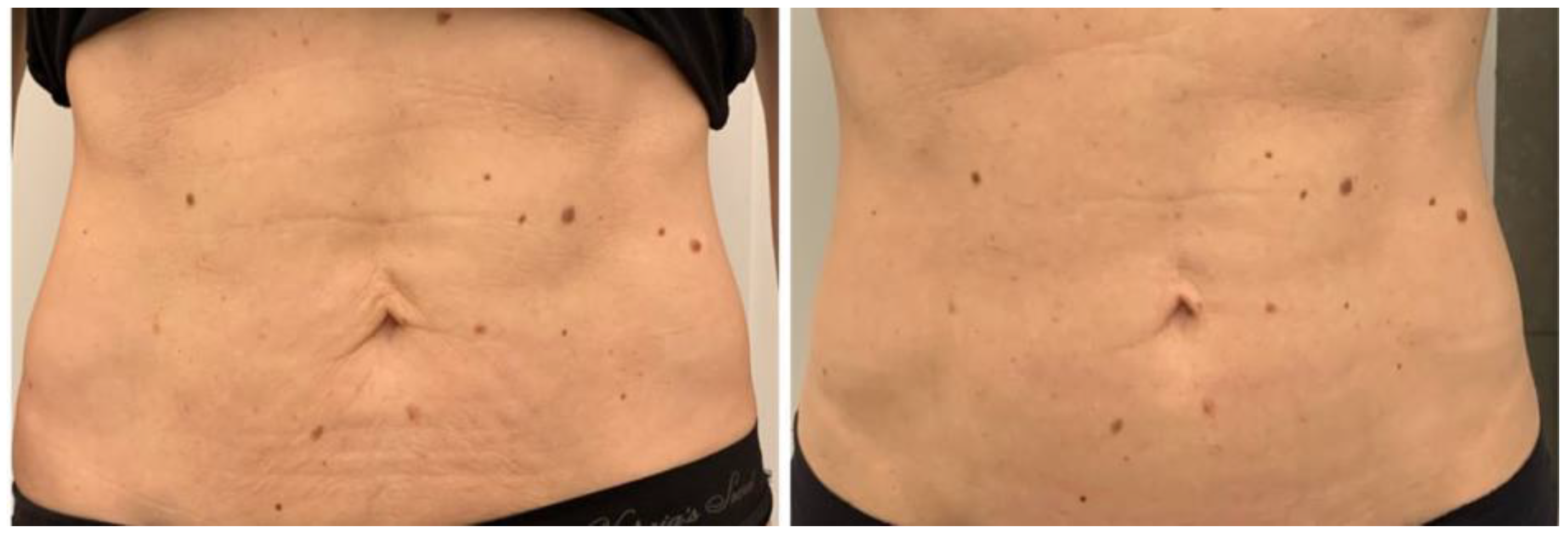 Bioengineering 09 00284 g004 550