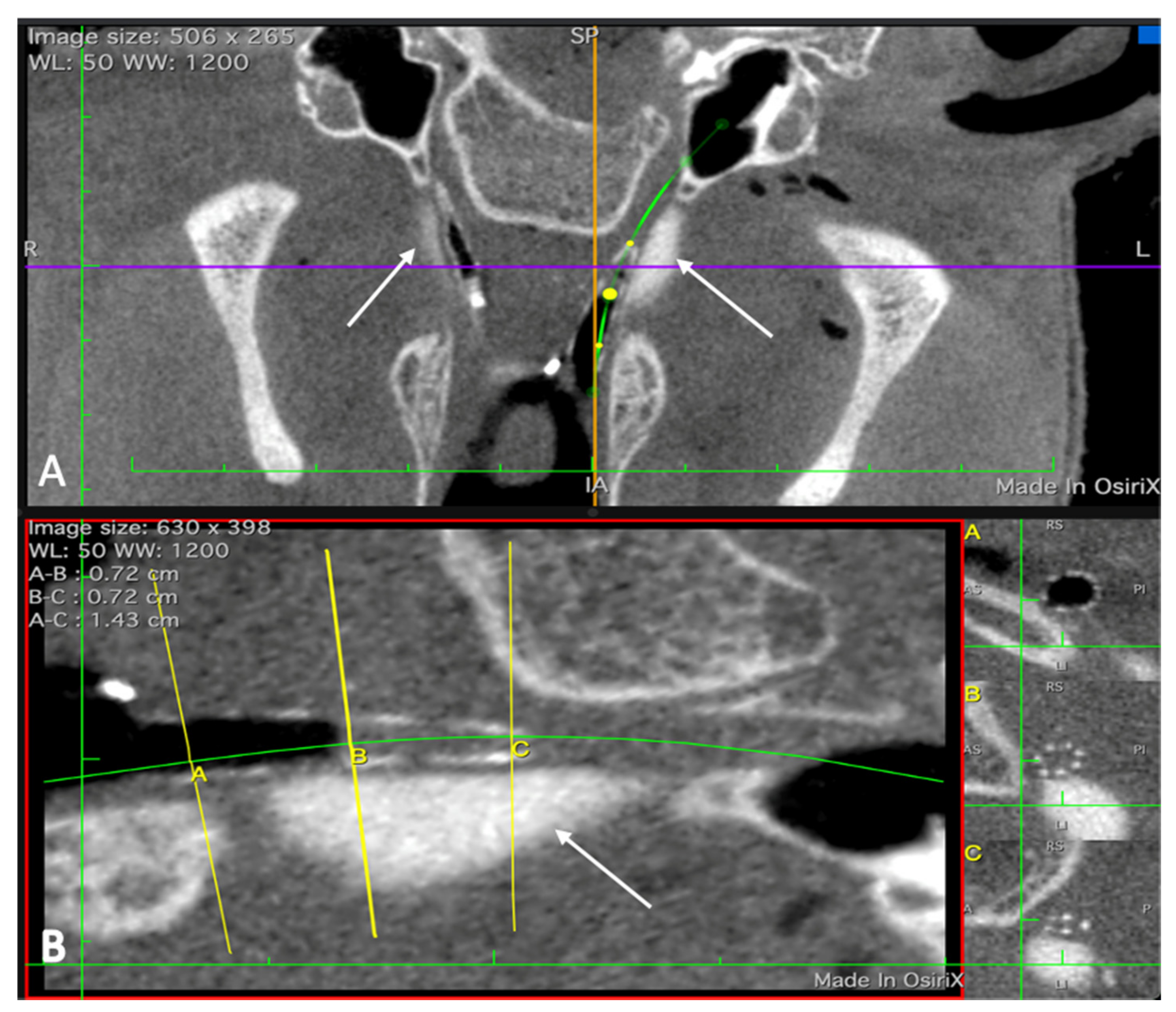 Bioengineering 09 00317 g005 Bioengineering 09 00317 g005
