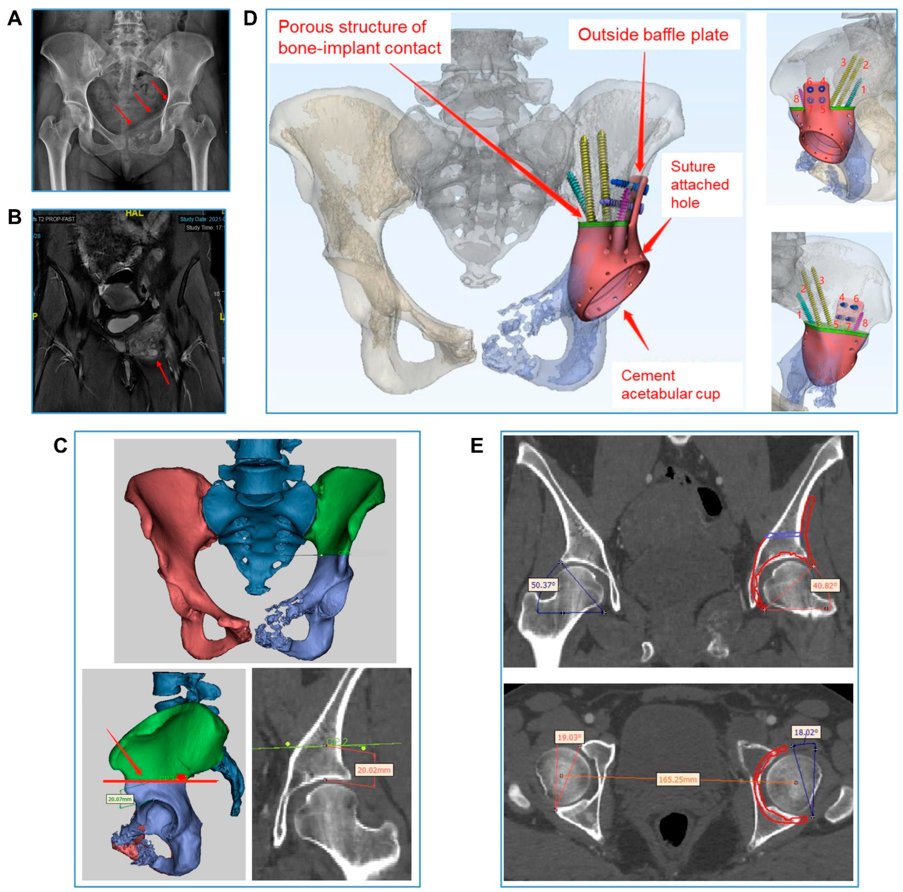 Bioengineering 09 00400 g003 Bioengineering 09 00400 g003