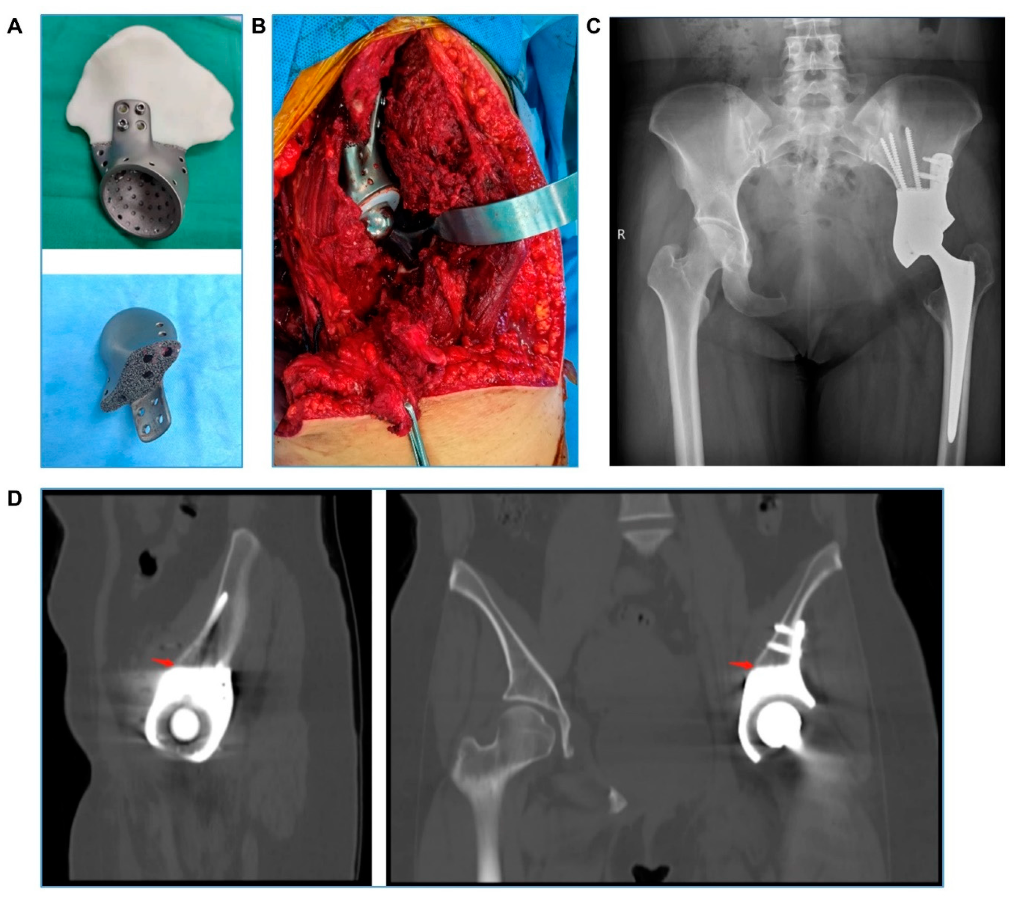 Bioengineering 09 00400 g004 Bioengineering 09 00400 g004