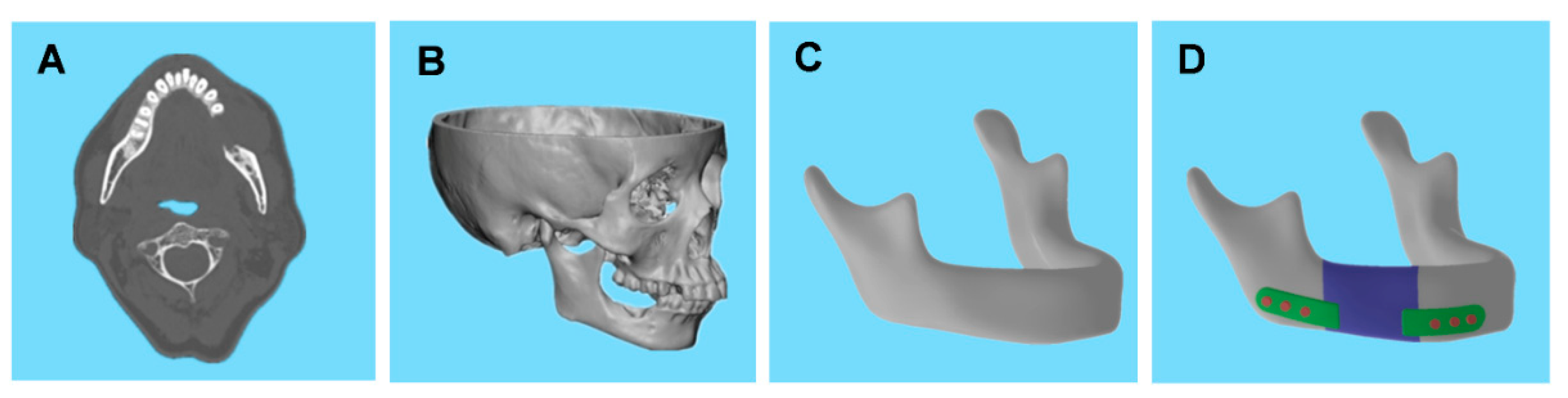 Bioengineering 09 00424 g002 550