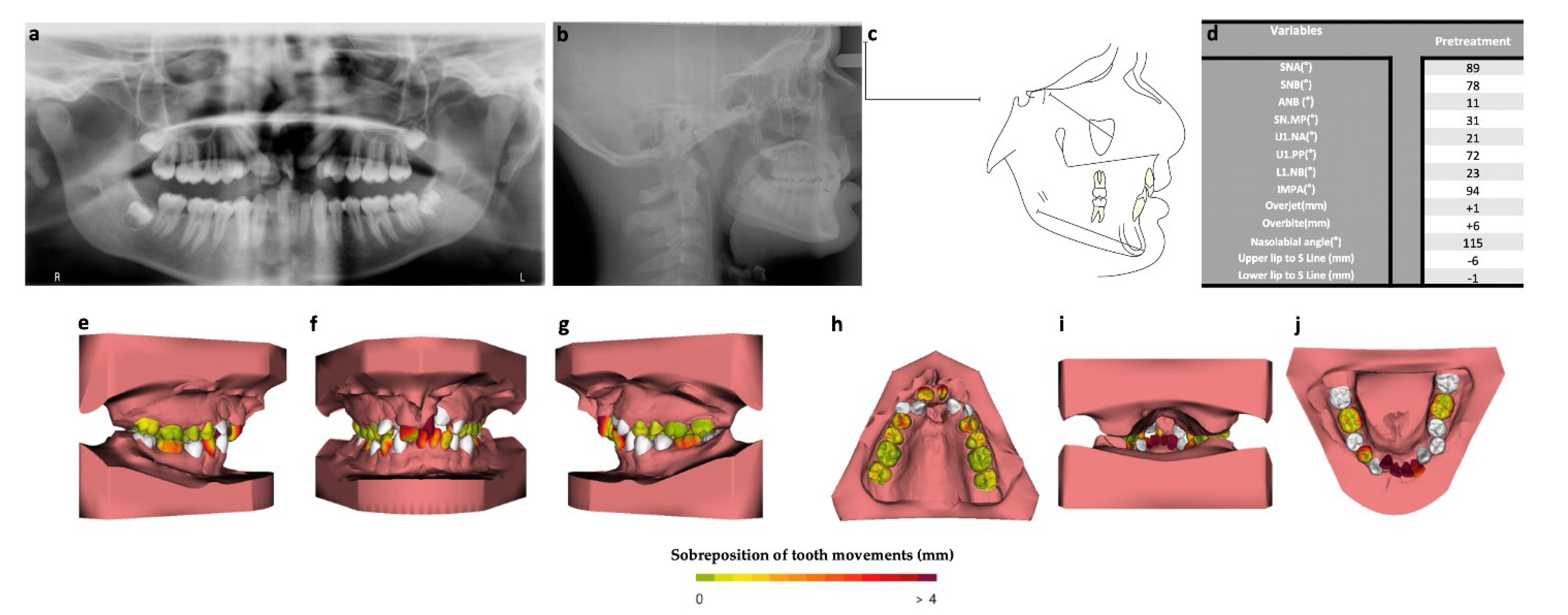 Bioengineering 09 00455 g002 550