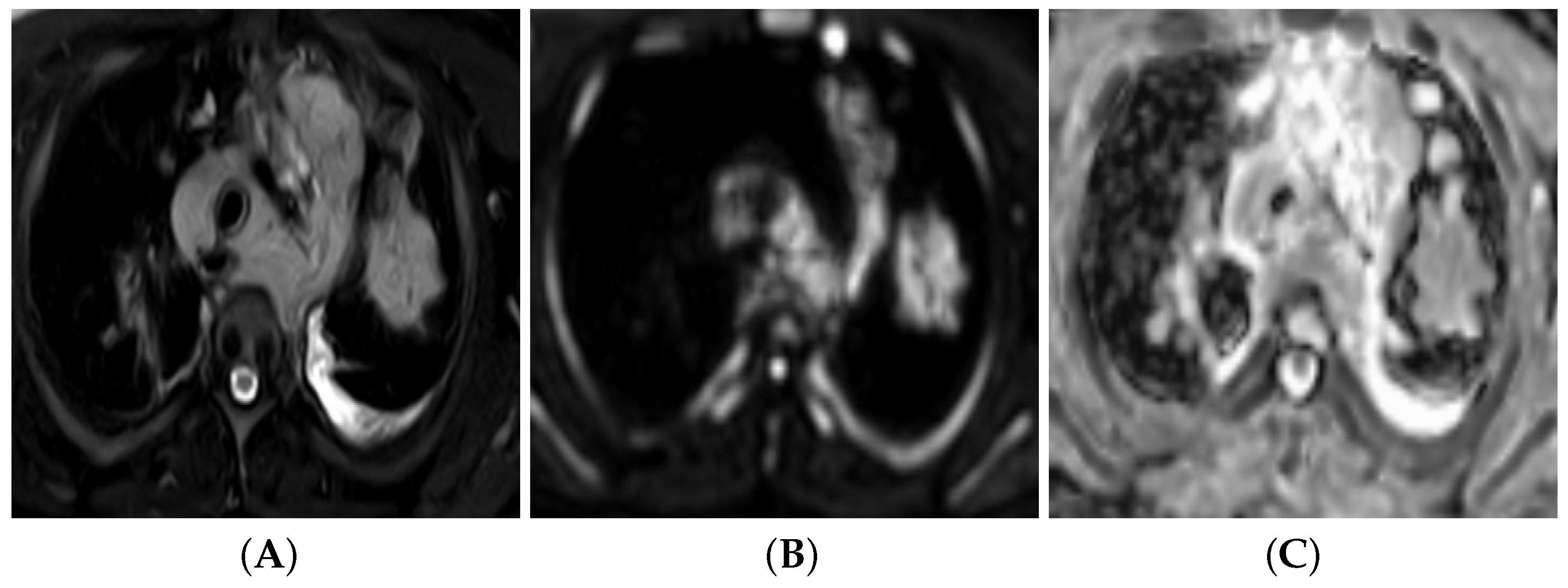 Bioengineering 09 00493 g003