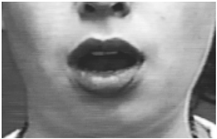 Bioengineering 09 00510 i022