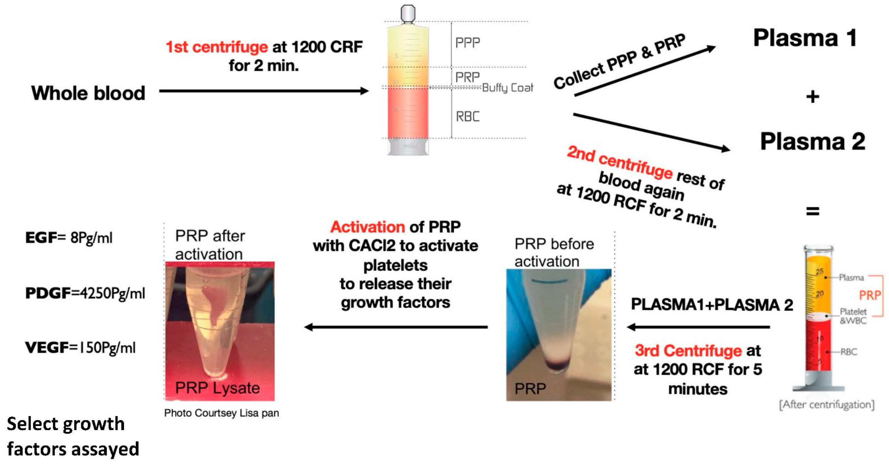 Platelet-Rich Plasma Lysate-Incorporating Gelatin Hydrogel as a 