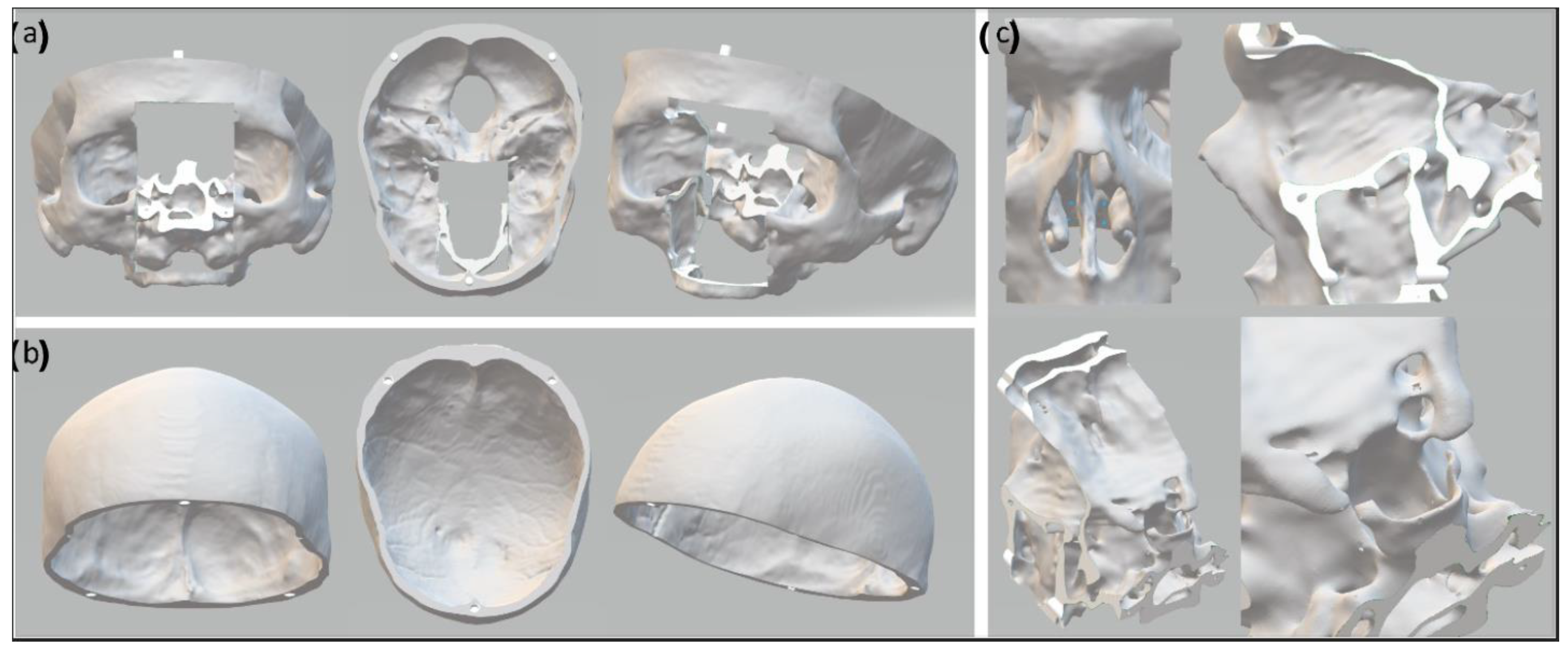 Bioengineering 09 00537 g002 Bioengineering 09 00537 g002
