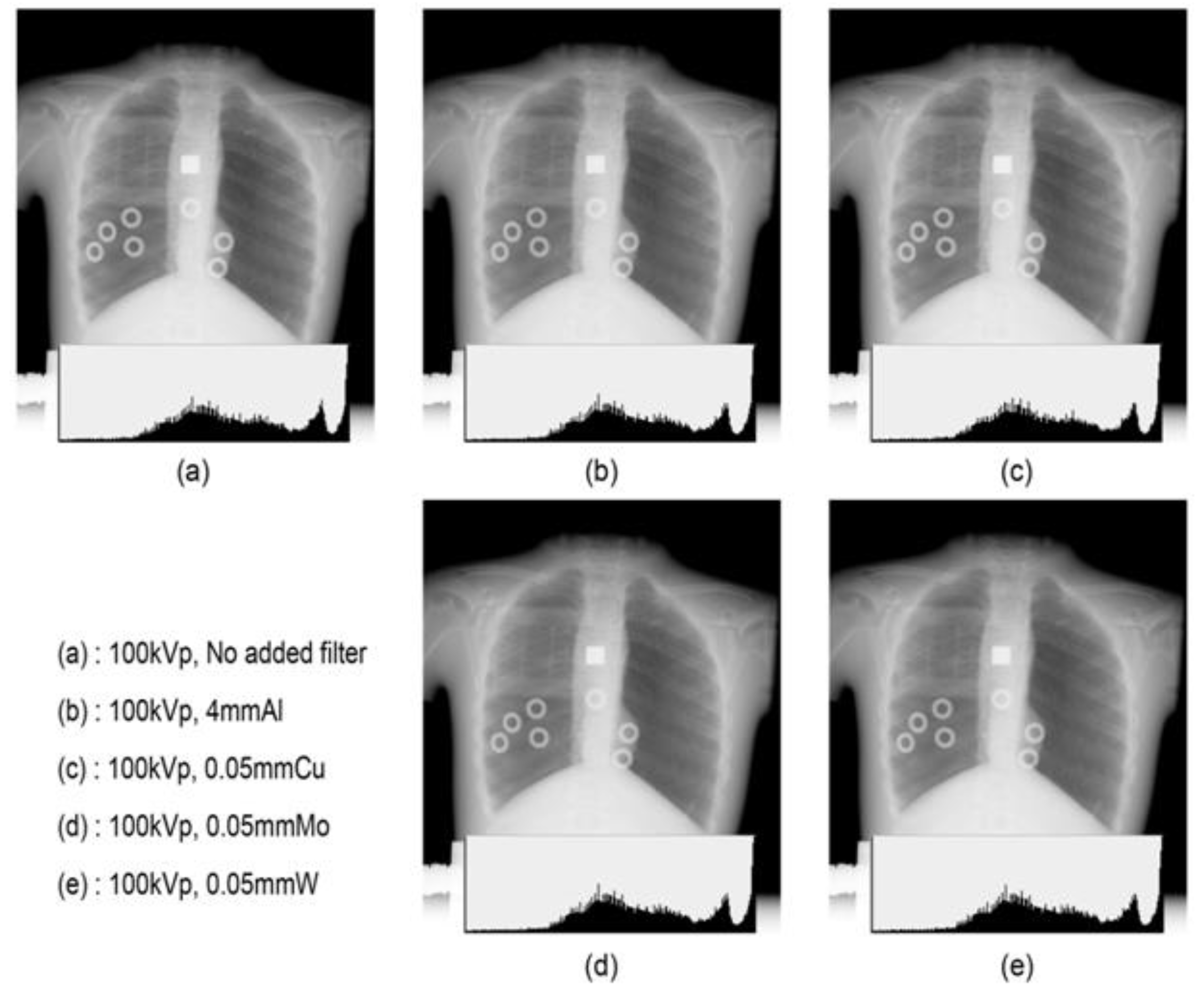 Bioengineering Free FullText Dose Reduction and Image Quality