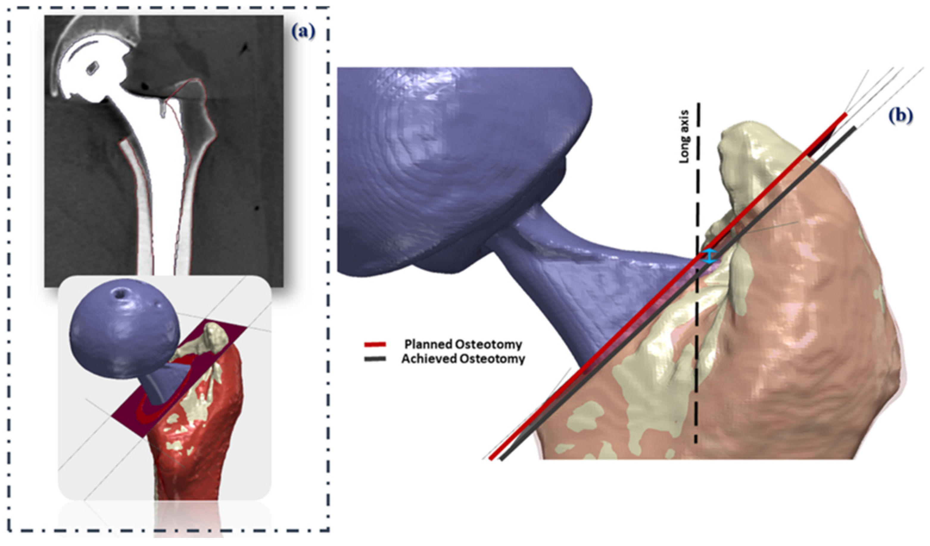 Bioengineering 09 00667 g004