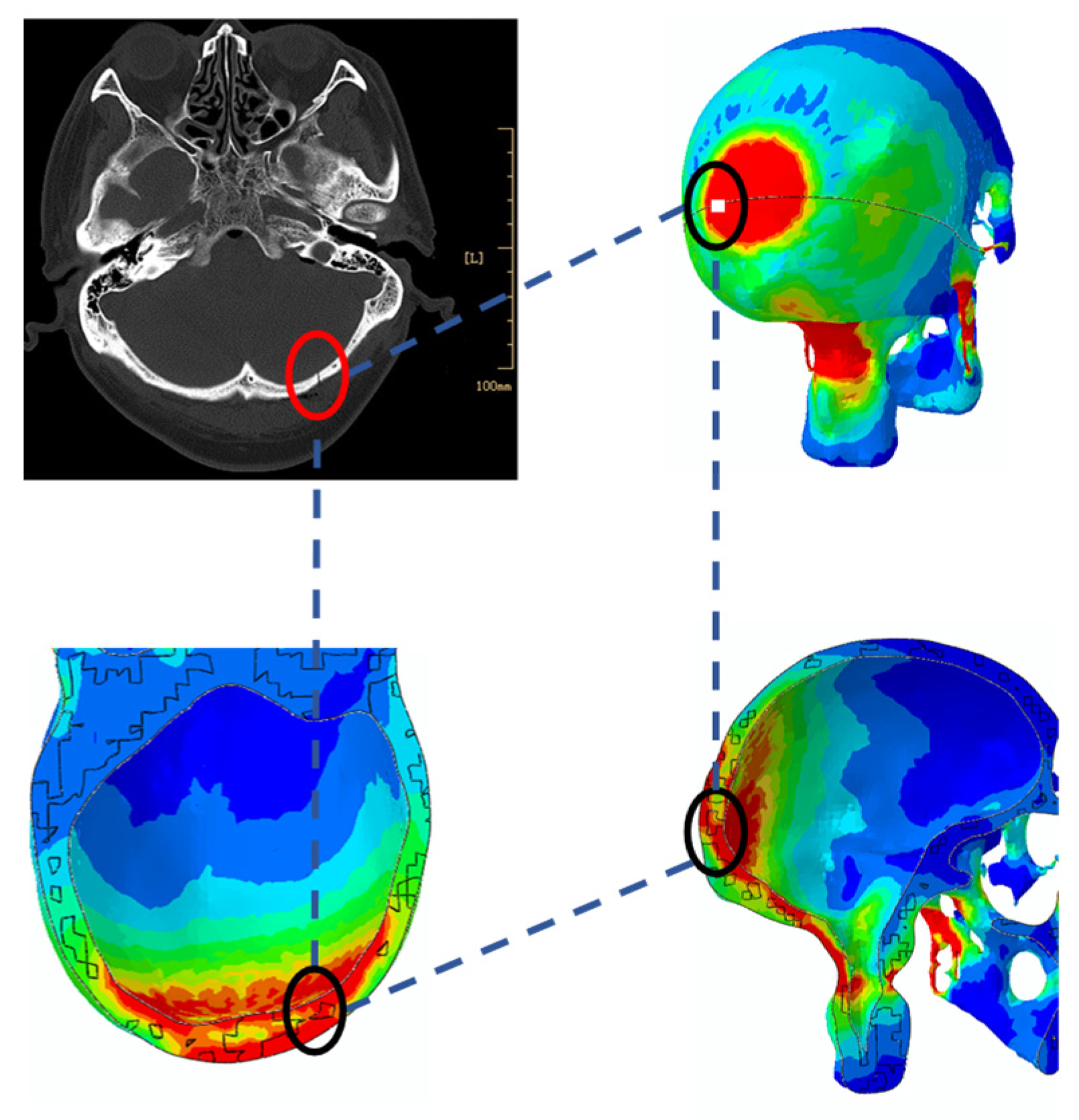 Bioengineering 09 00723 g008 Bioengineering 09 00723 g008