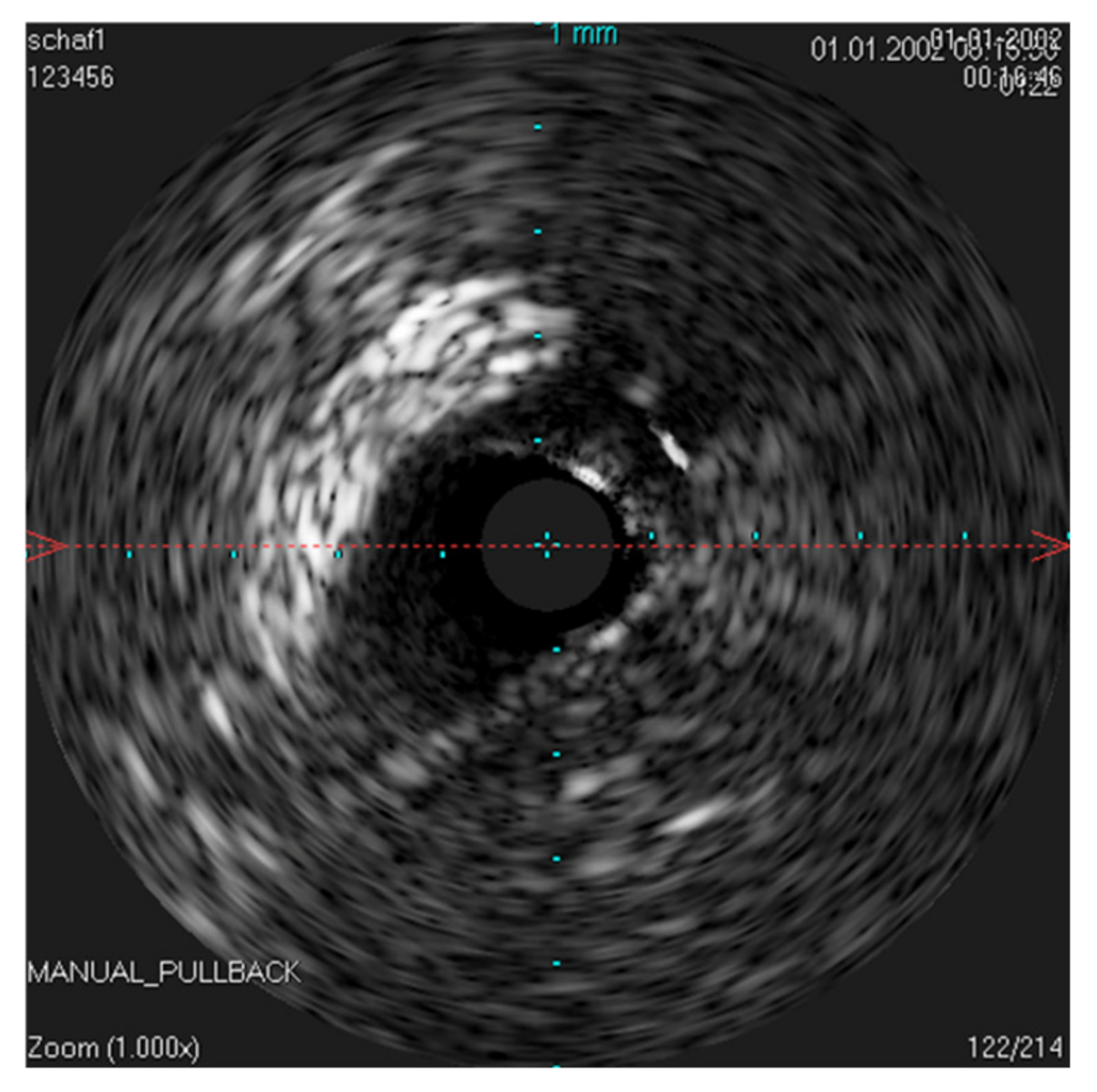 Bioengineering 09 00733 g003