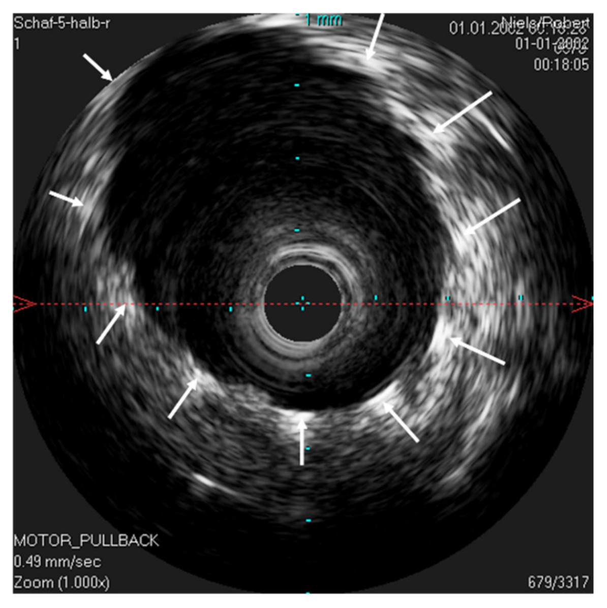 Bioengineering 09 00733 g007