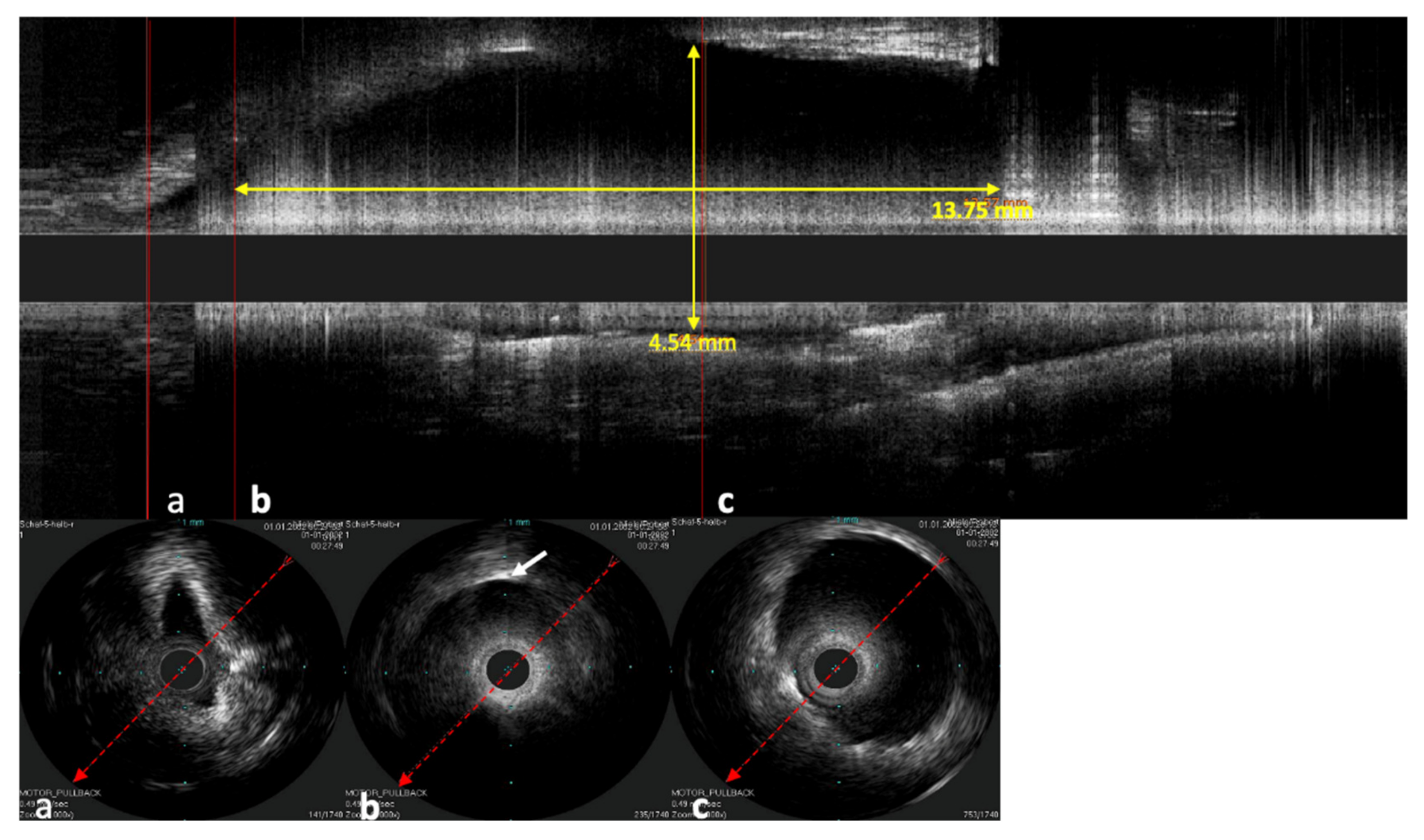 Bioengineering 09 00733 g008