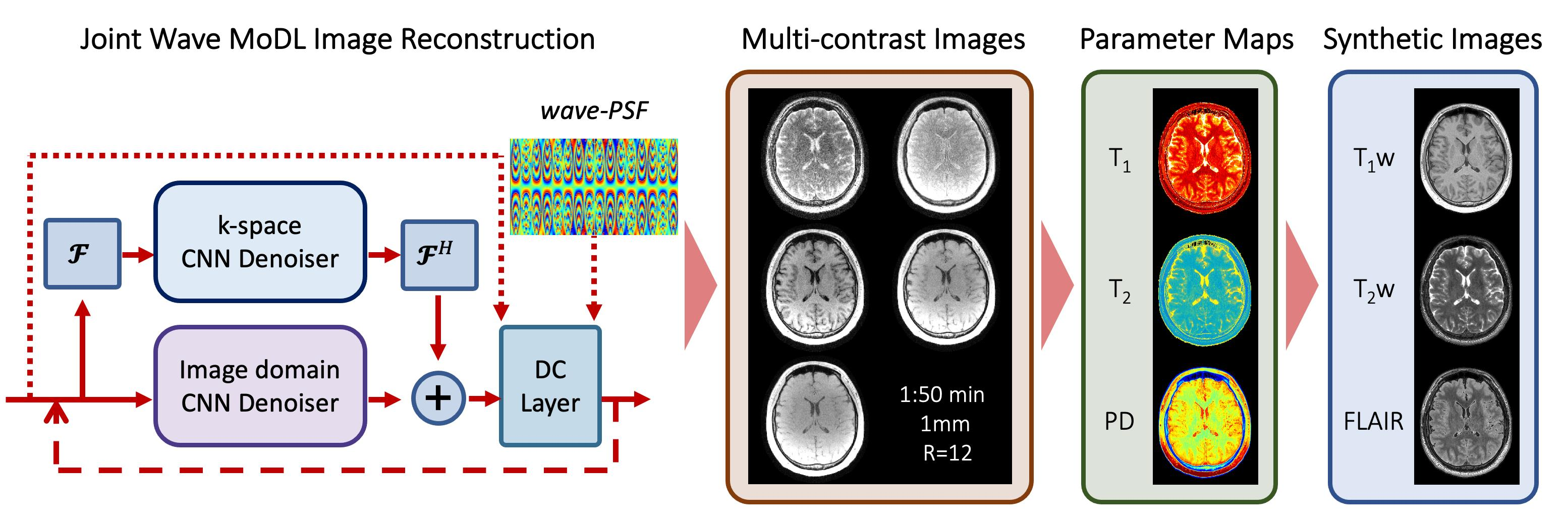Bioengineering | Free Full-Text | Wave-Encoded Model-Based Deep ...