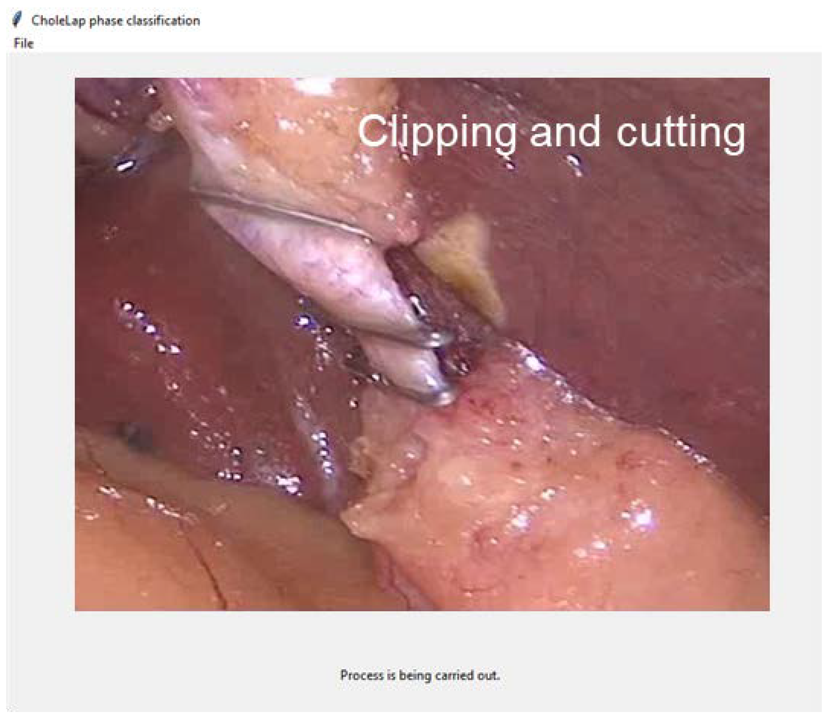 Bioengineering 09 00753 g005