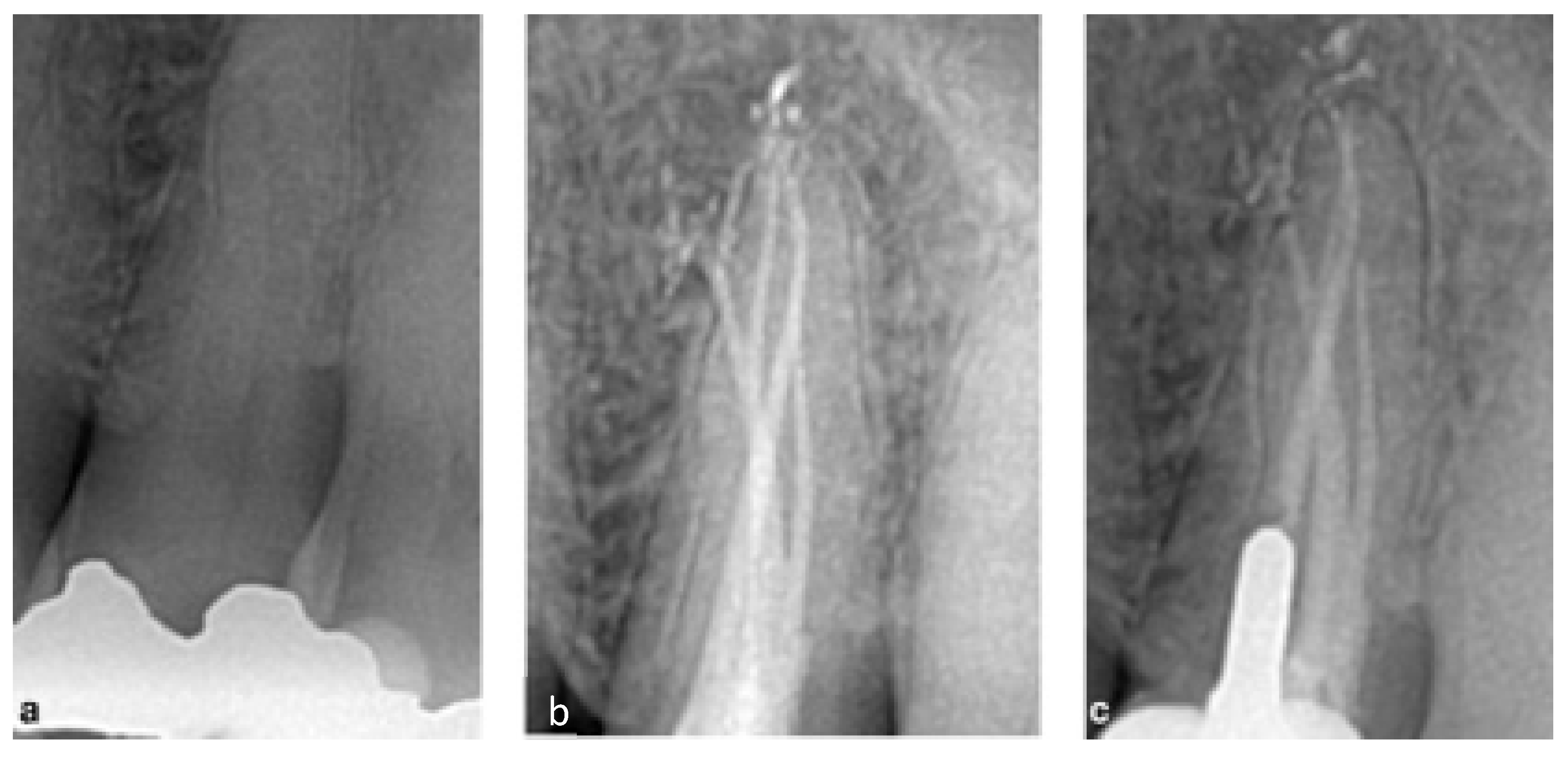 Bioengineering 09 00757 g005 Bioengineering 09 00757 g005