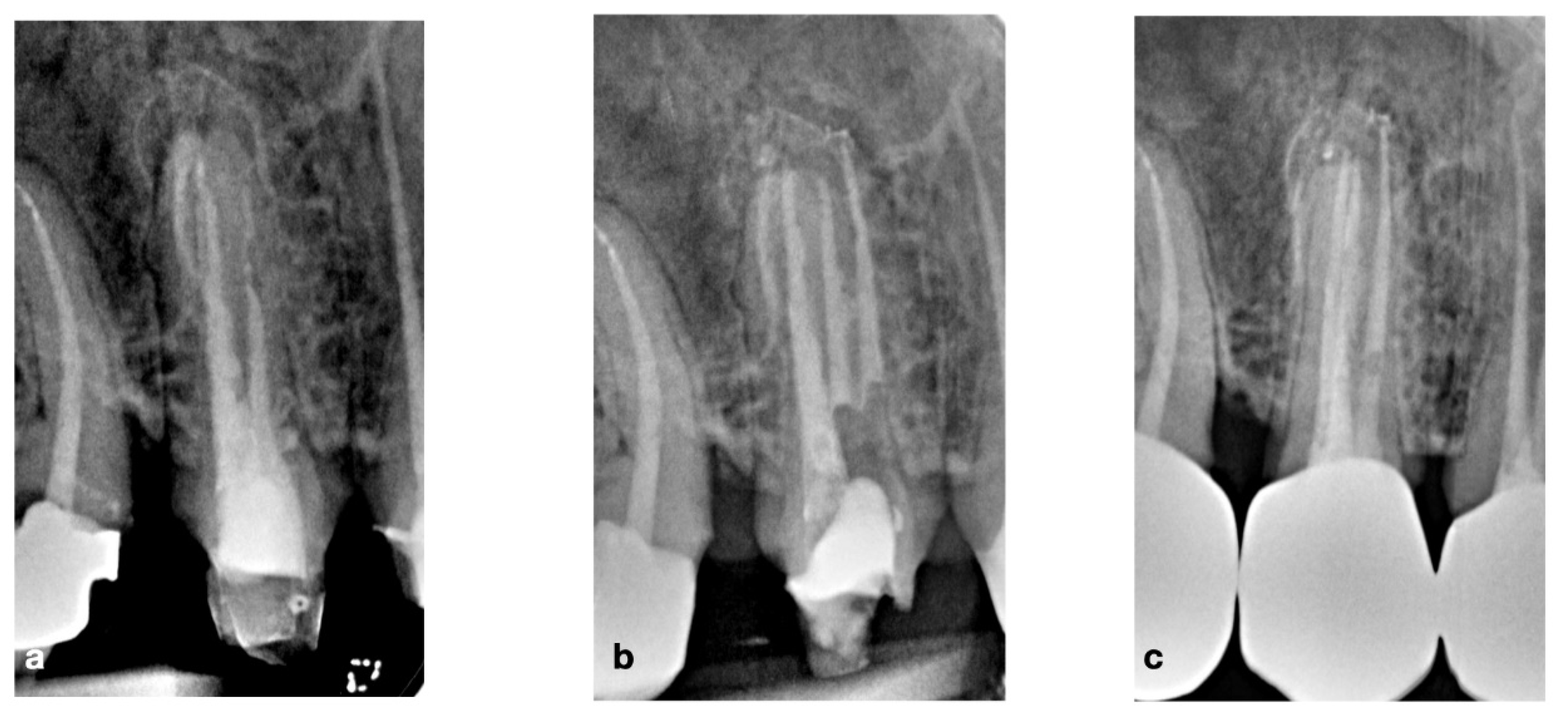 Bioengineering 09 00757 g006 Bioengineering 09 00757 g006