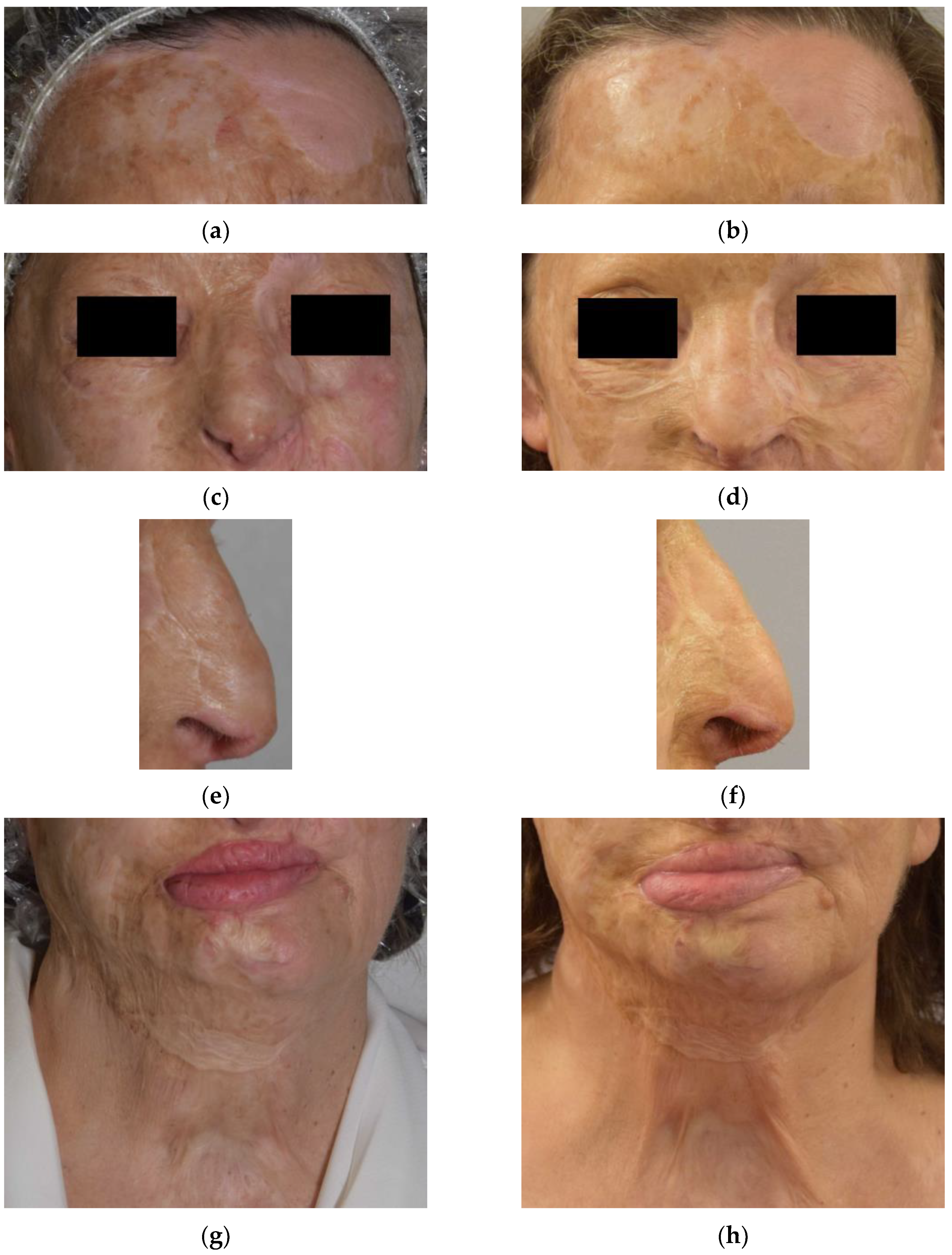 Bioengineering 09 00799 g001 Bioengineering 09 00799 g001