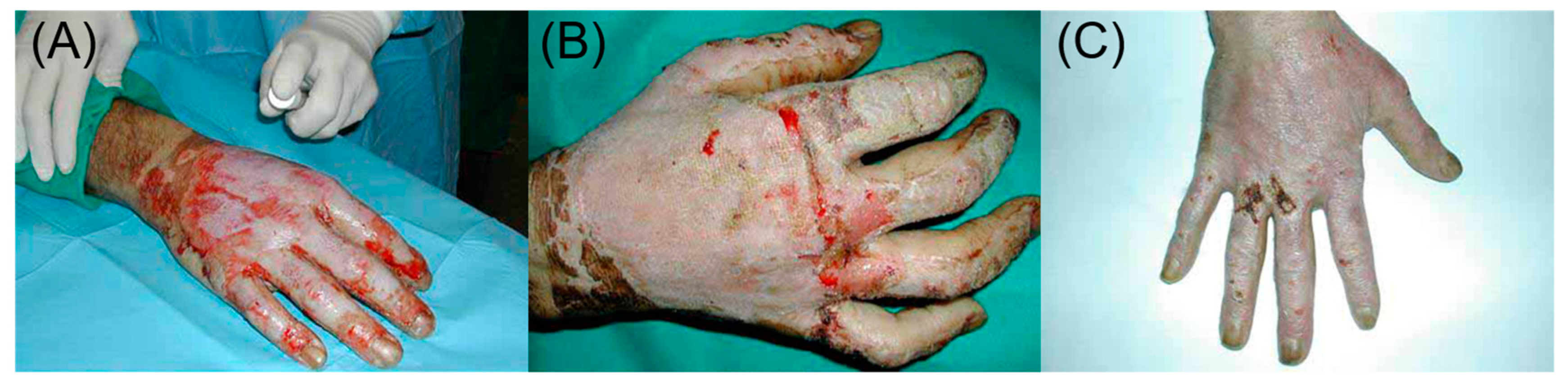 Bioengineering 10 00003 g001 Bioengineering 10 00003 g001