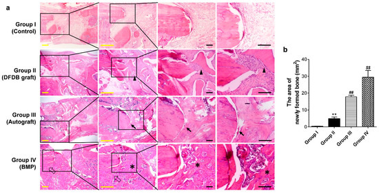 Alveolar socket healing in 5-lipoxygenase knockout aged