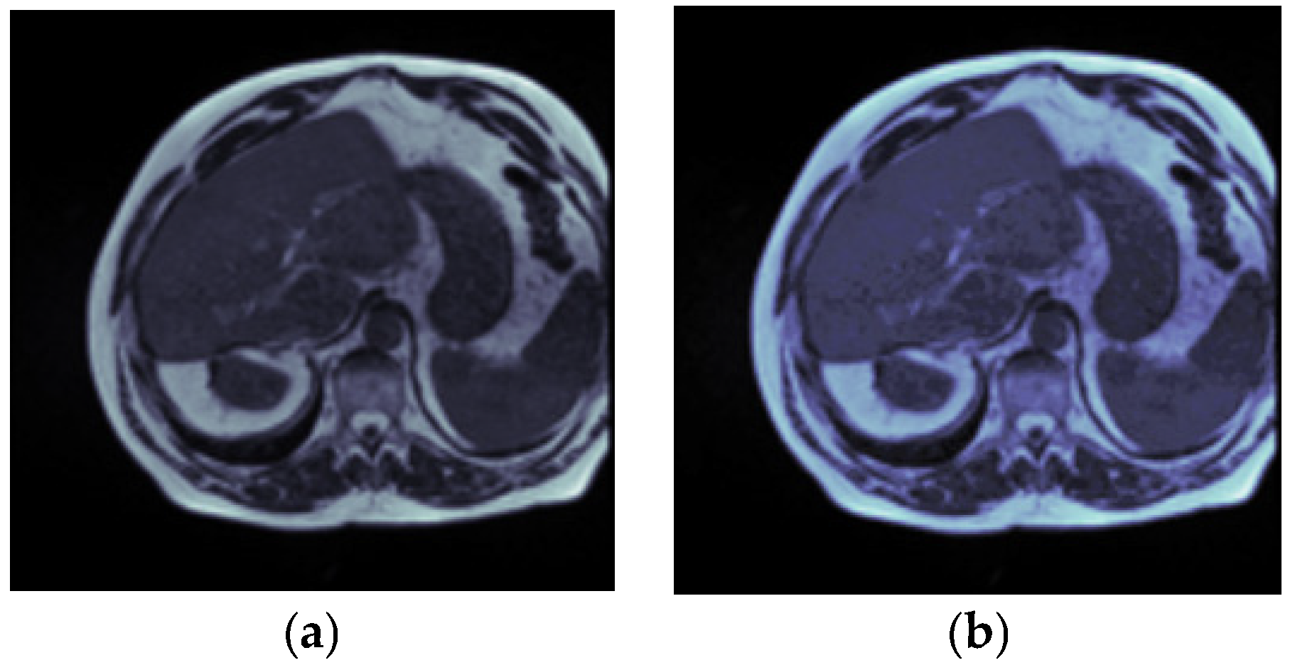 Bioengineering 10 00119 g005