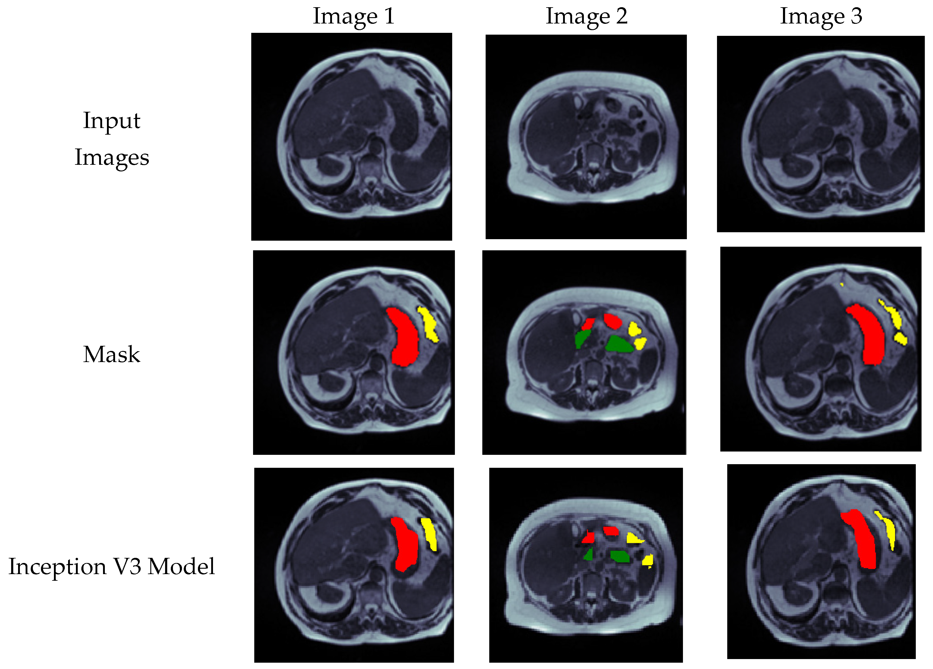 Bioengineering 10 00119 g014a