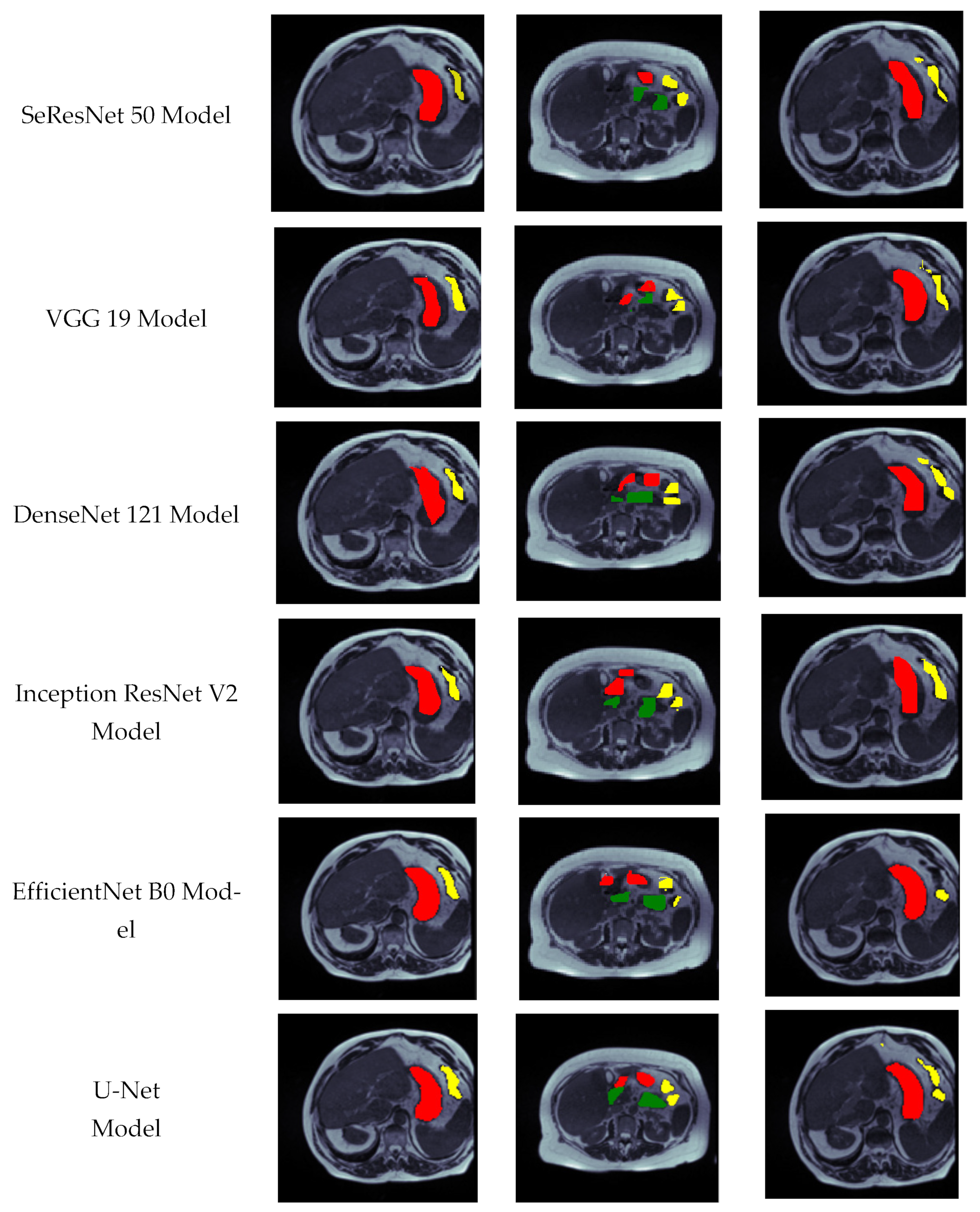 Bioengineering 10 00119 g014b