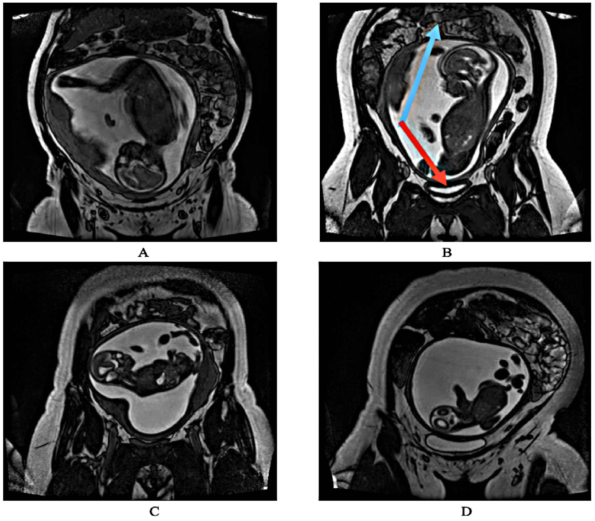 Bioengineering 10 00140 g001