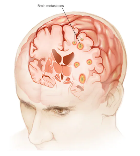 Bioengineering 10 00147 g006