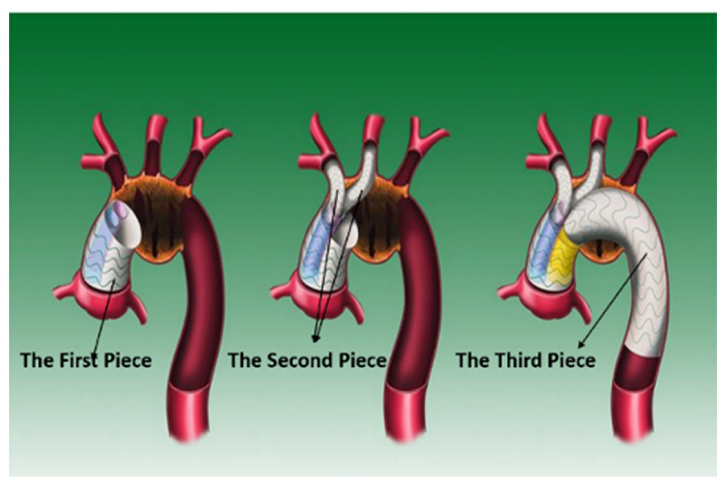 Bioengineering 10 00164 g001